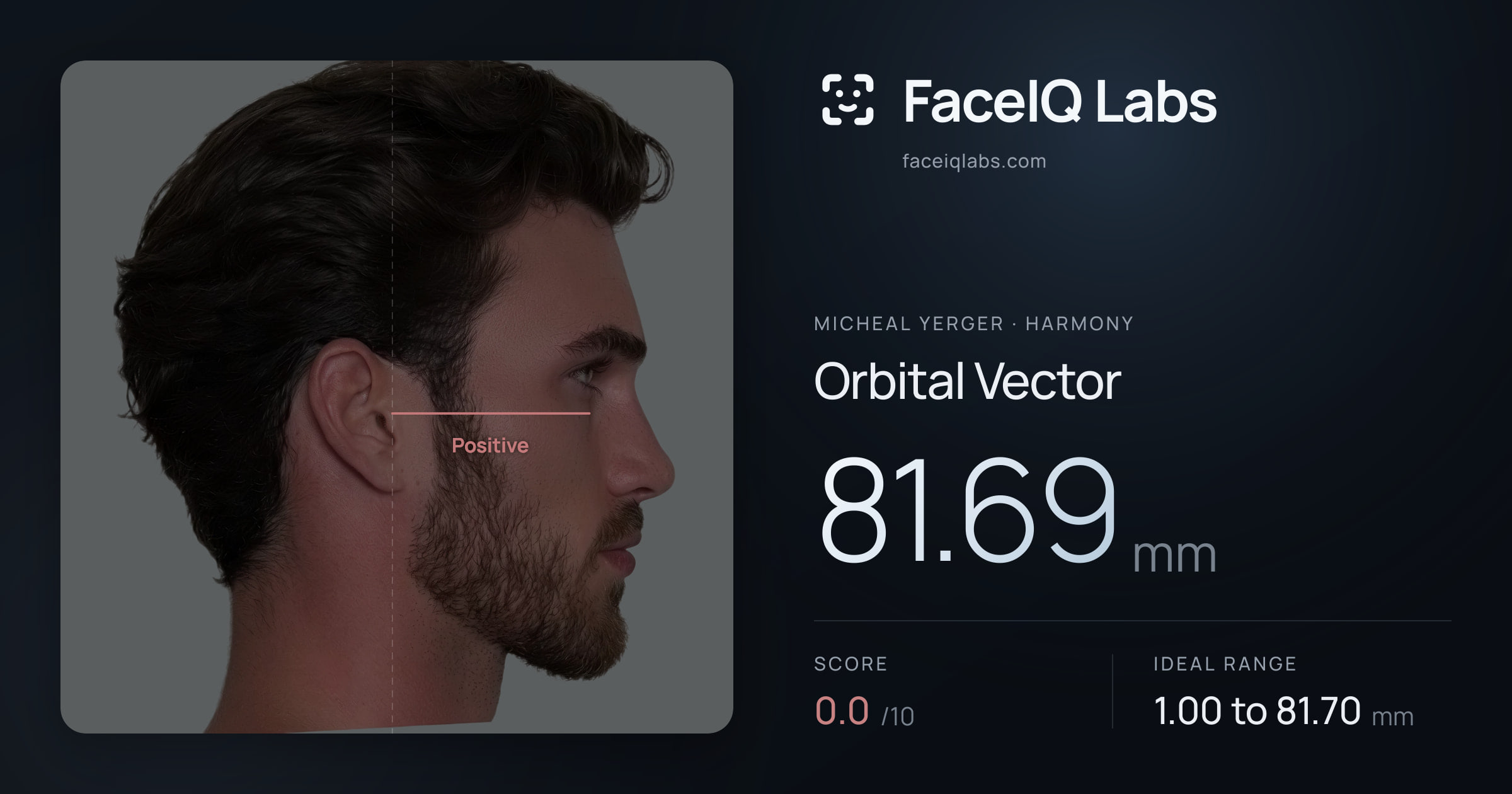 Micheal Yerger Orbital Vector: 81.69mm, drawn on the photo