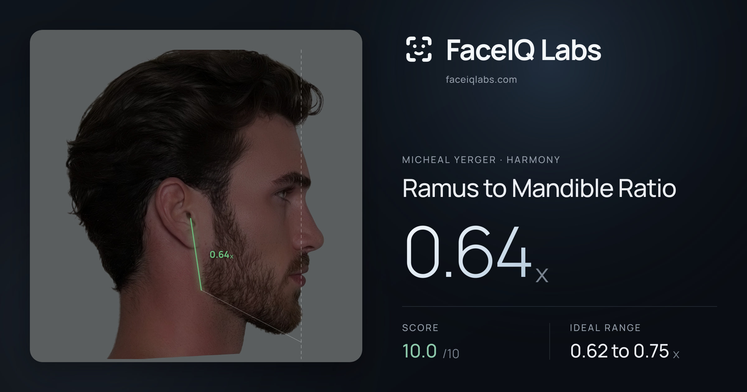 Micheal Yerger Ramus to Mandible Ratio: 0.64x, drawn on the photo