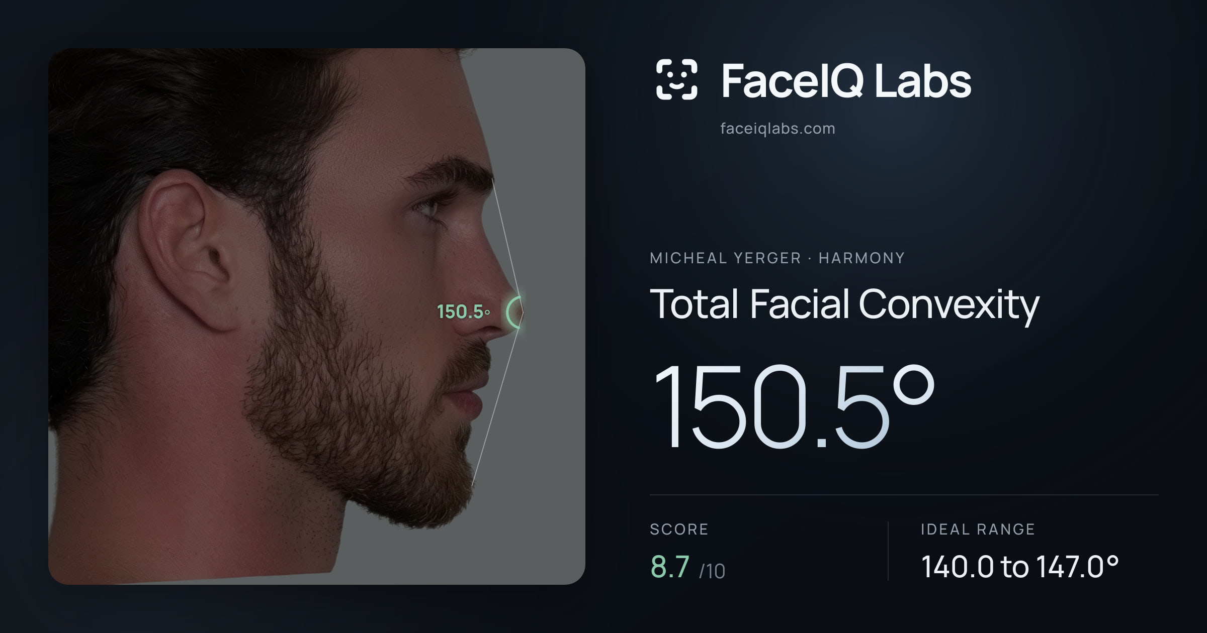 Micheal Yerger Total Facial Convexity: 150.5°, drawn on the photo