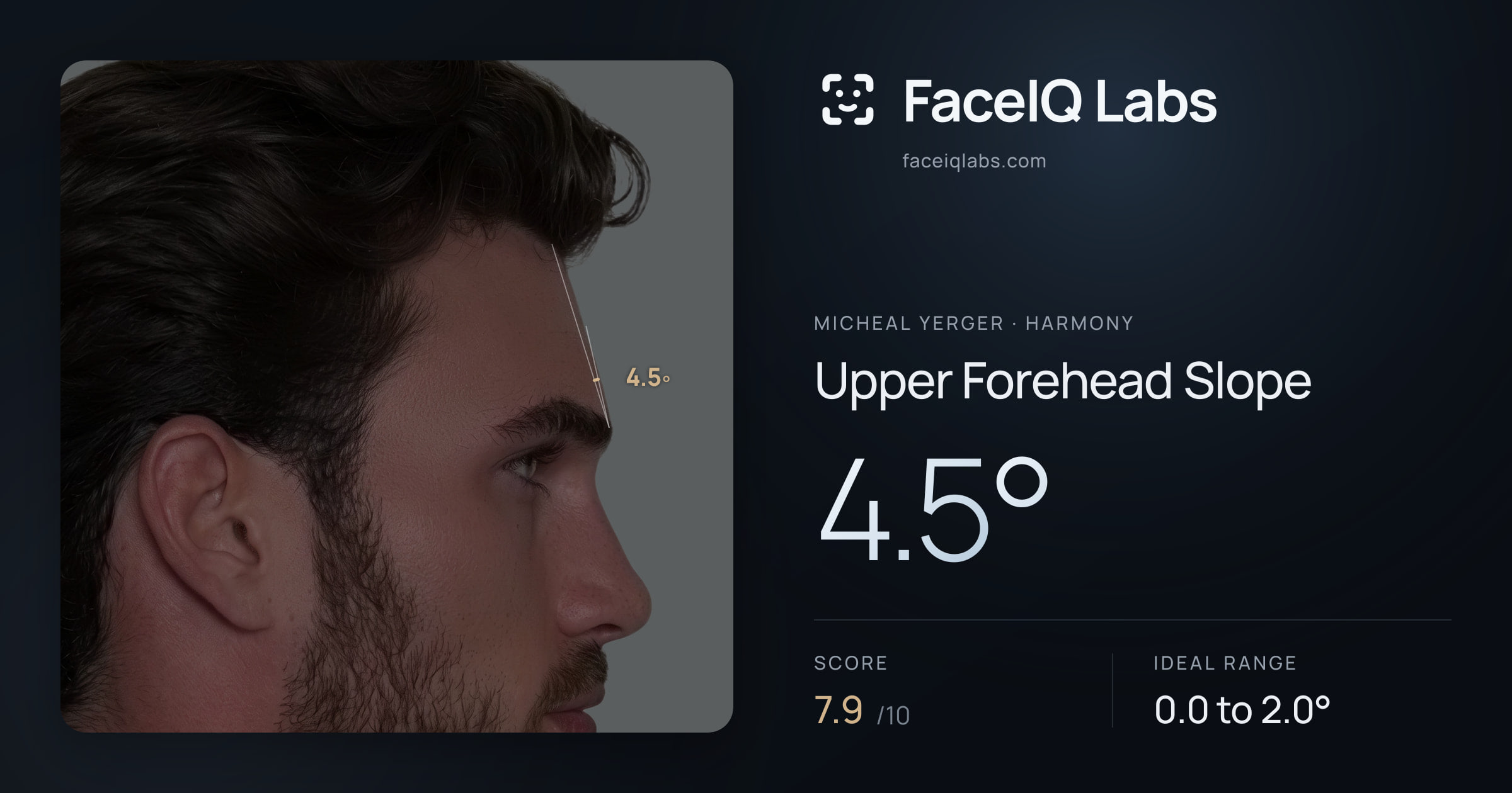 Micheal Yerger Upper Forehead Slope: 4.5°, drawn on the photo