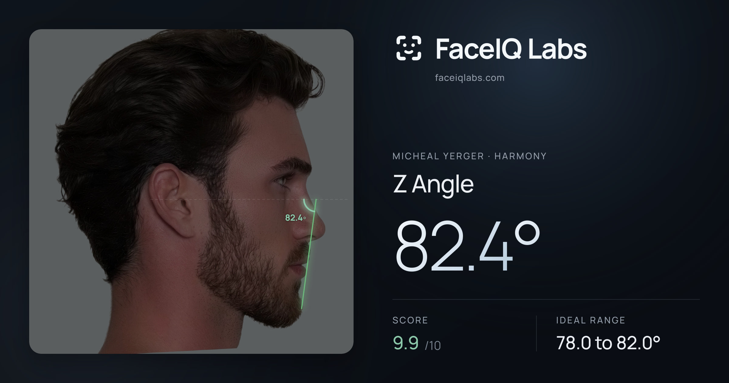 Micheal Yerger Z Angle: 82.4°, drawn on the photo