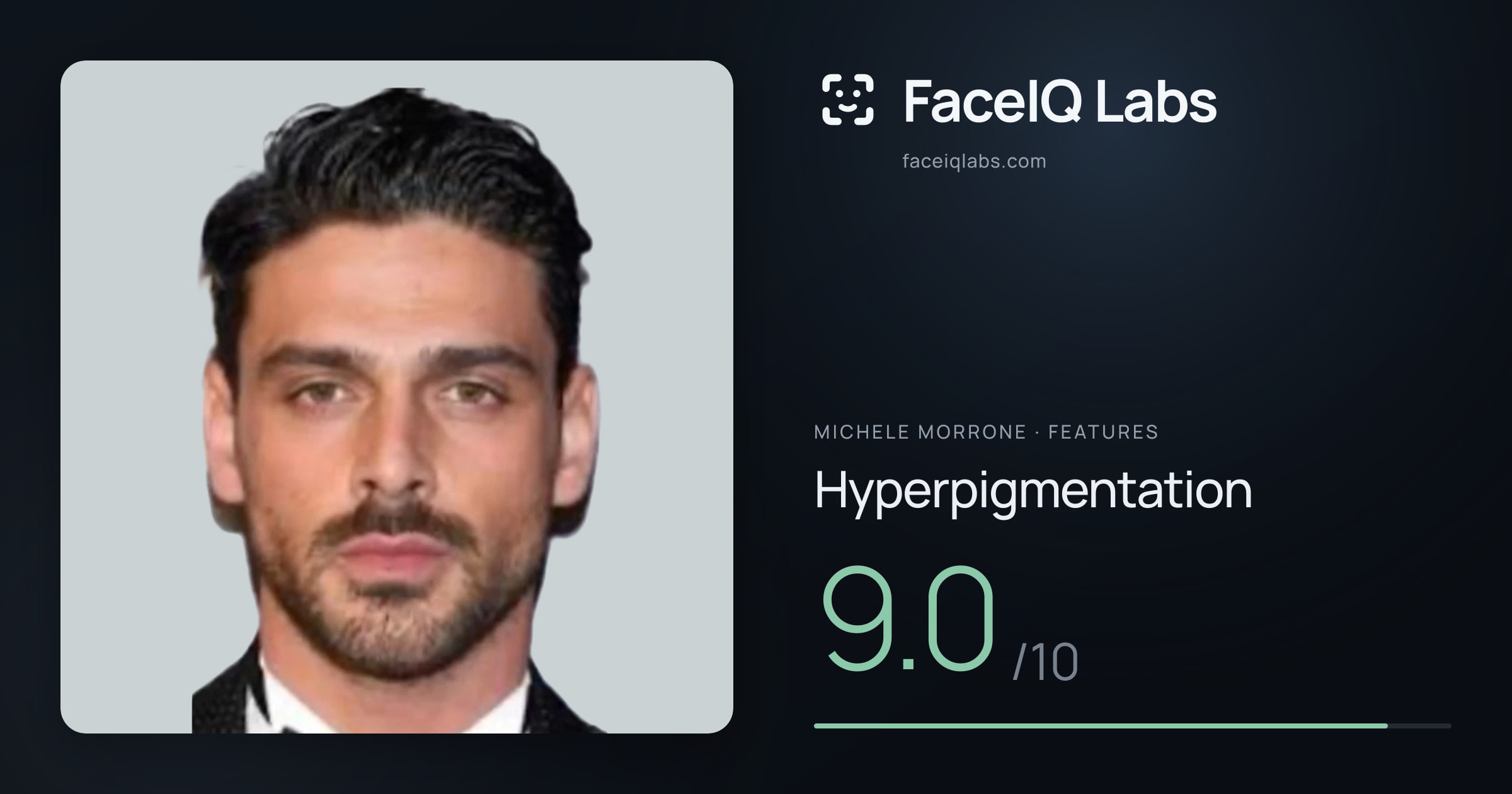 Michele Morrone Hyperpigmentation: 9.0/10, drawn on the photo