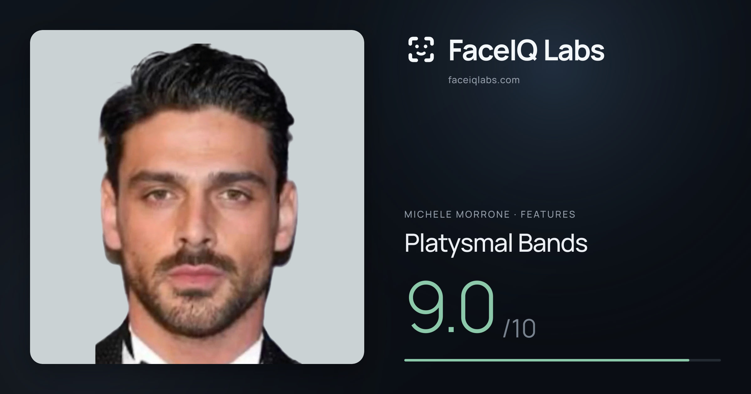 Michele Morrone Platysmal Bands: 9.0/10, drawn on the photo