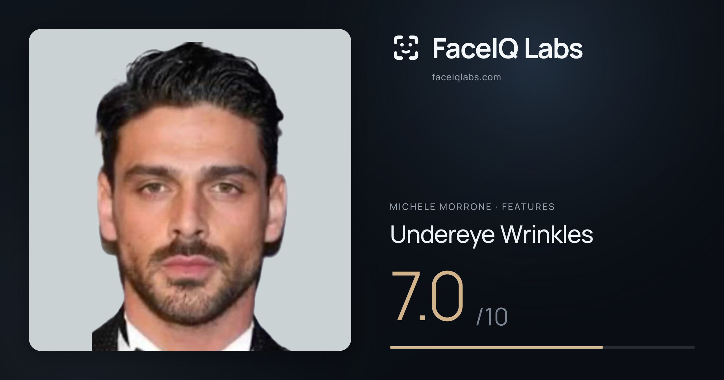 Michele Morrone Undereye Wrinkles: 7.0/10, drawn on the photo
