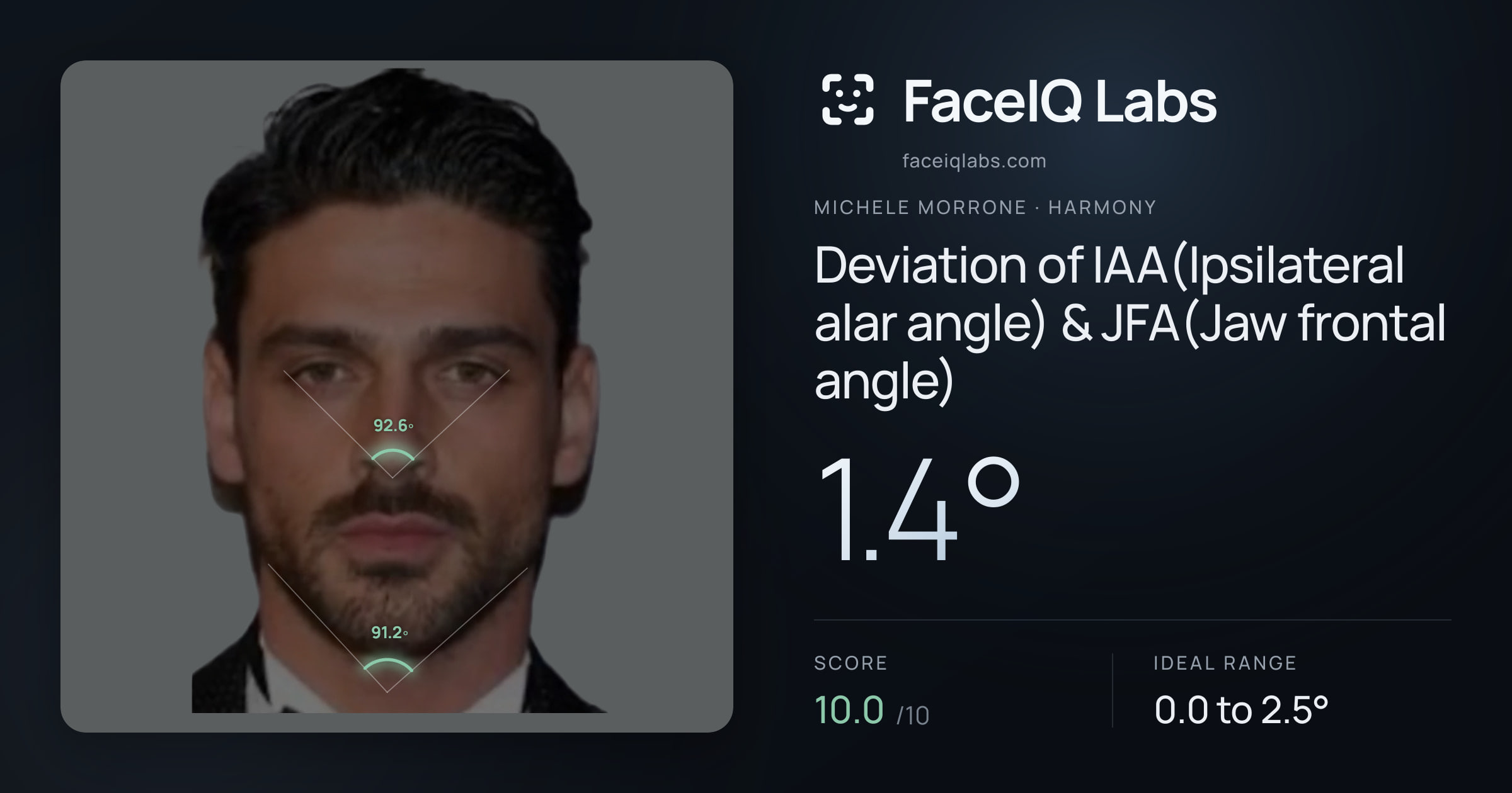 Michele Morrone Deviation of IAA(Ipsilateral alar angle) & JFA(Jaw frontal angle): 1.4°, drawn on the photo