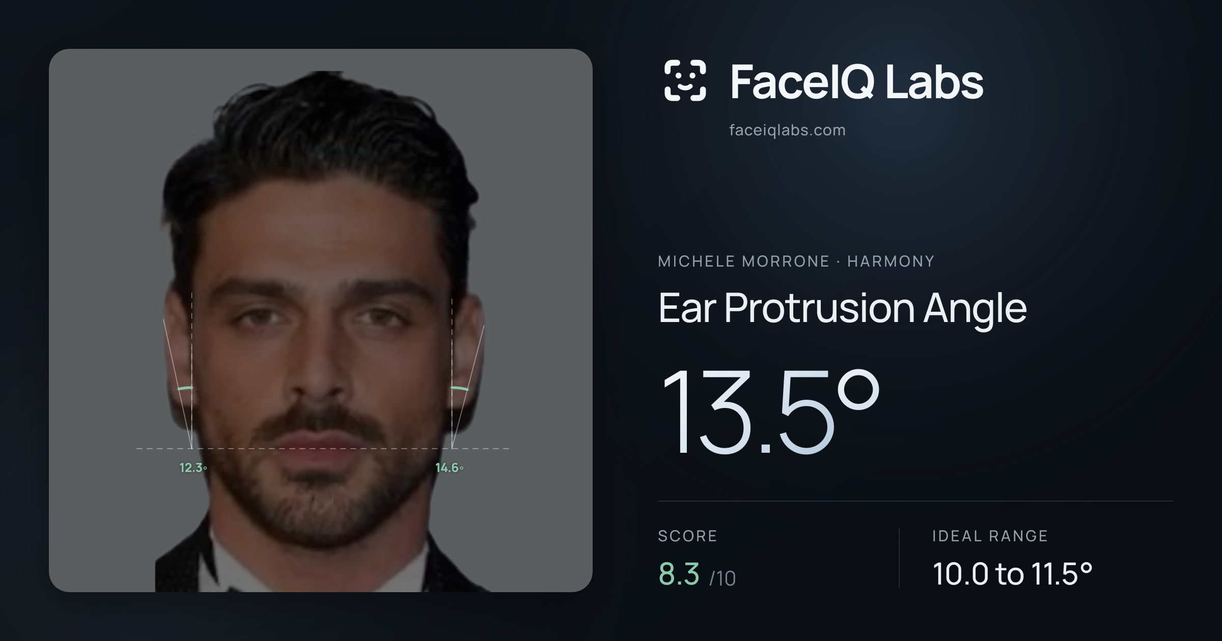 Michele Morrone Ear Protrusion Angle: 13.5°, drawn on the photo