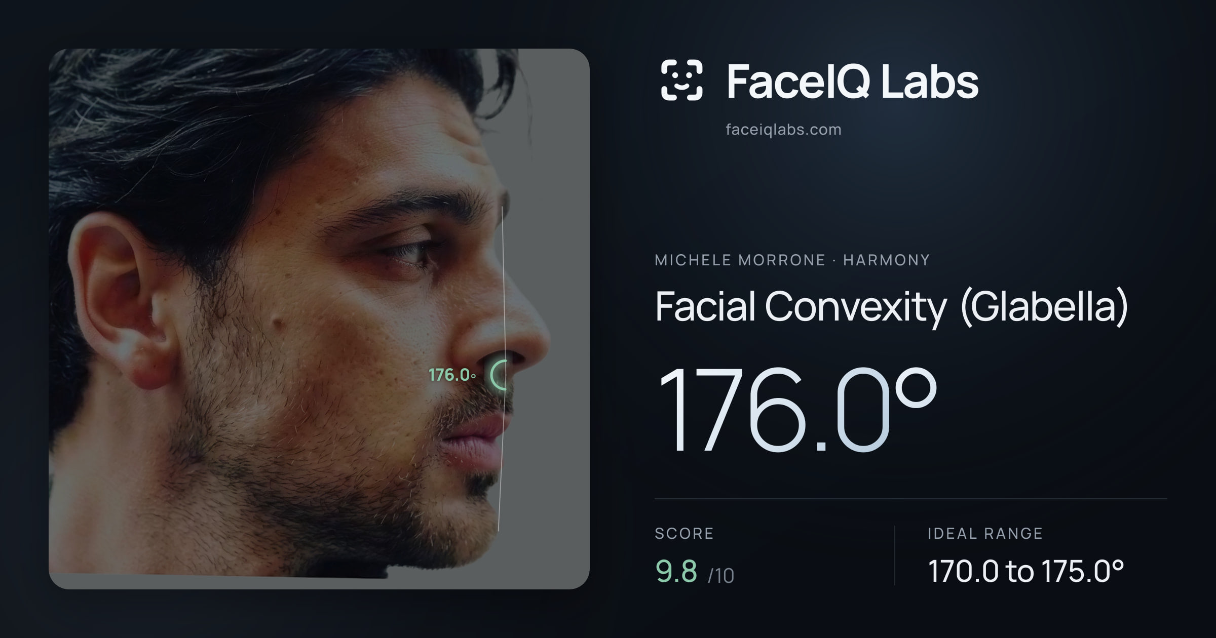 Michele Morrone Facial Convexity (Glabella): 176.0°, drawn on the photo