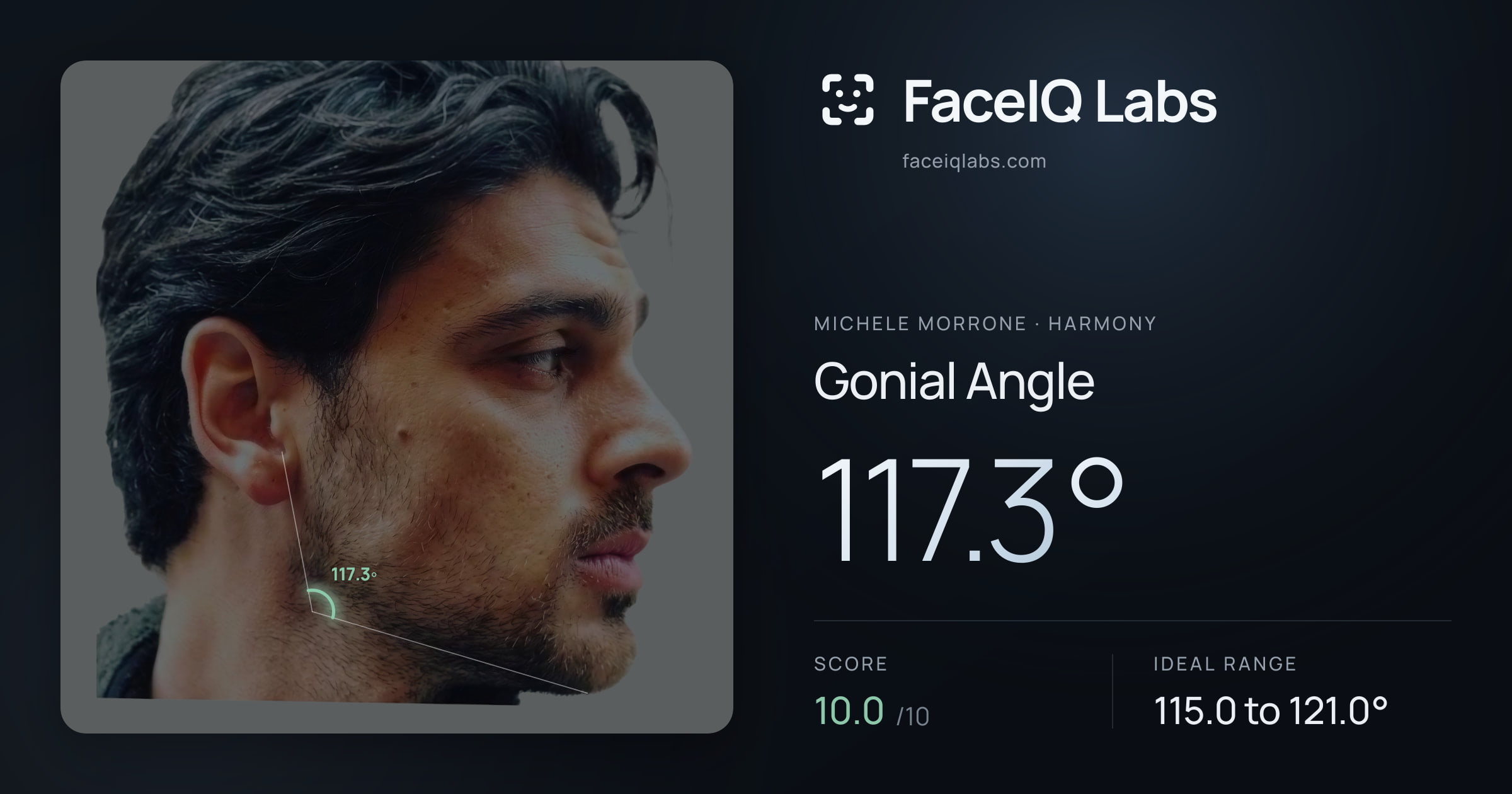 Michele Morrone Gonial Angle: 117.3°, drawn on the photo