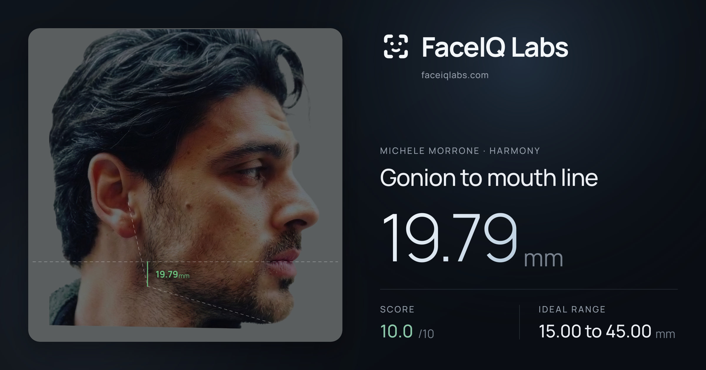 Michele Morrone Gonion to mouth line: 19.79mm, drawn on the photo