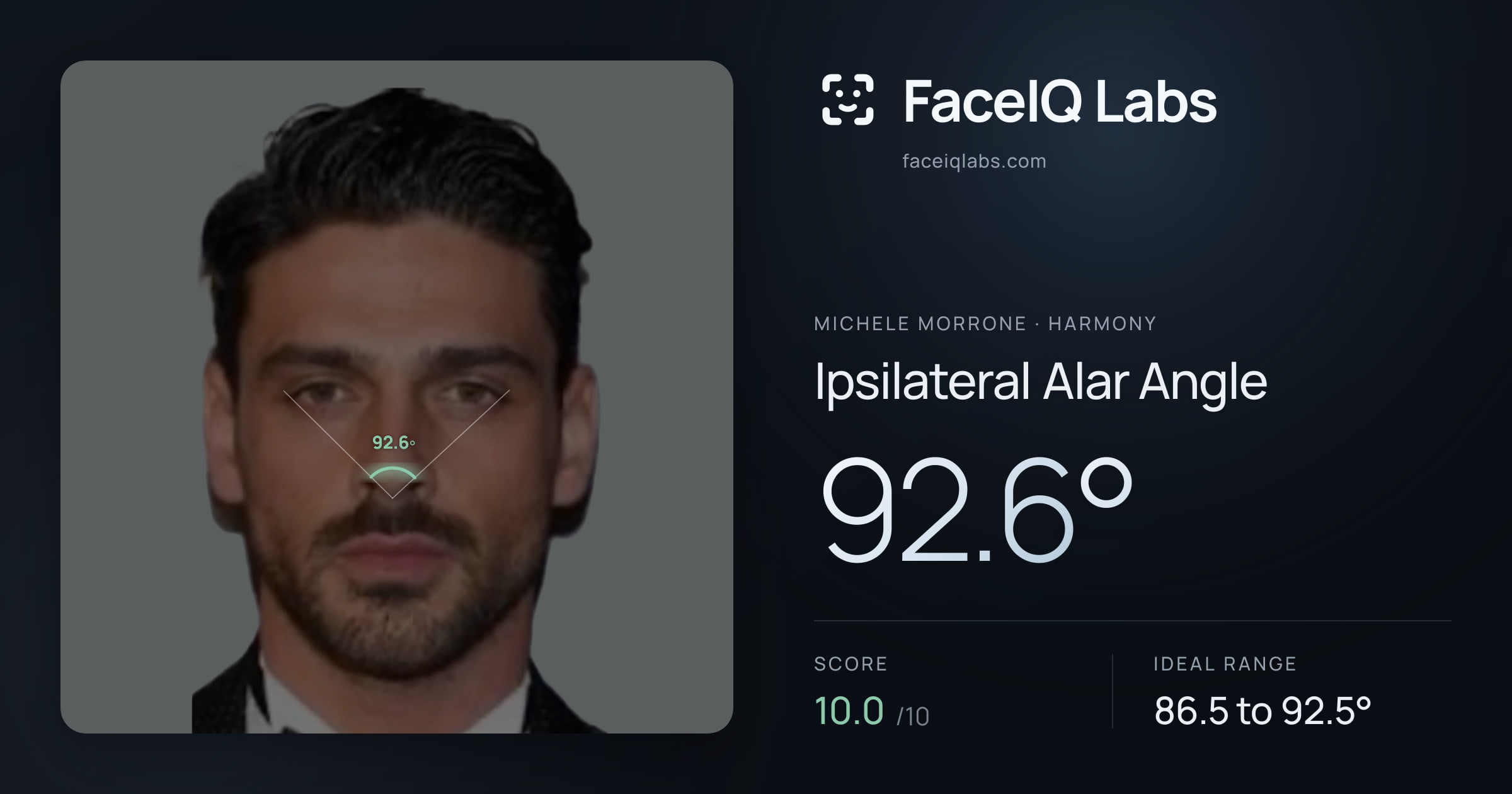 Michele Morrone Ipsilateral Alar Angle: 92.6°, drawn on the photo