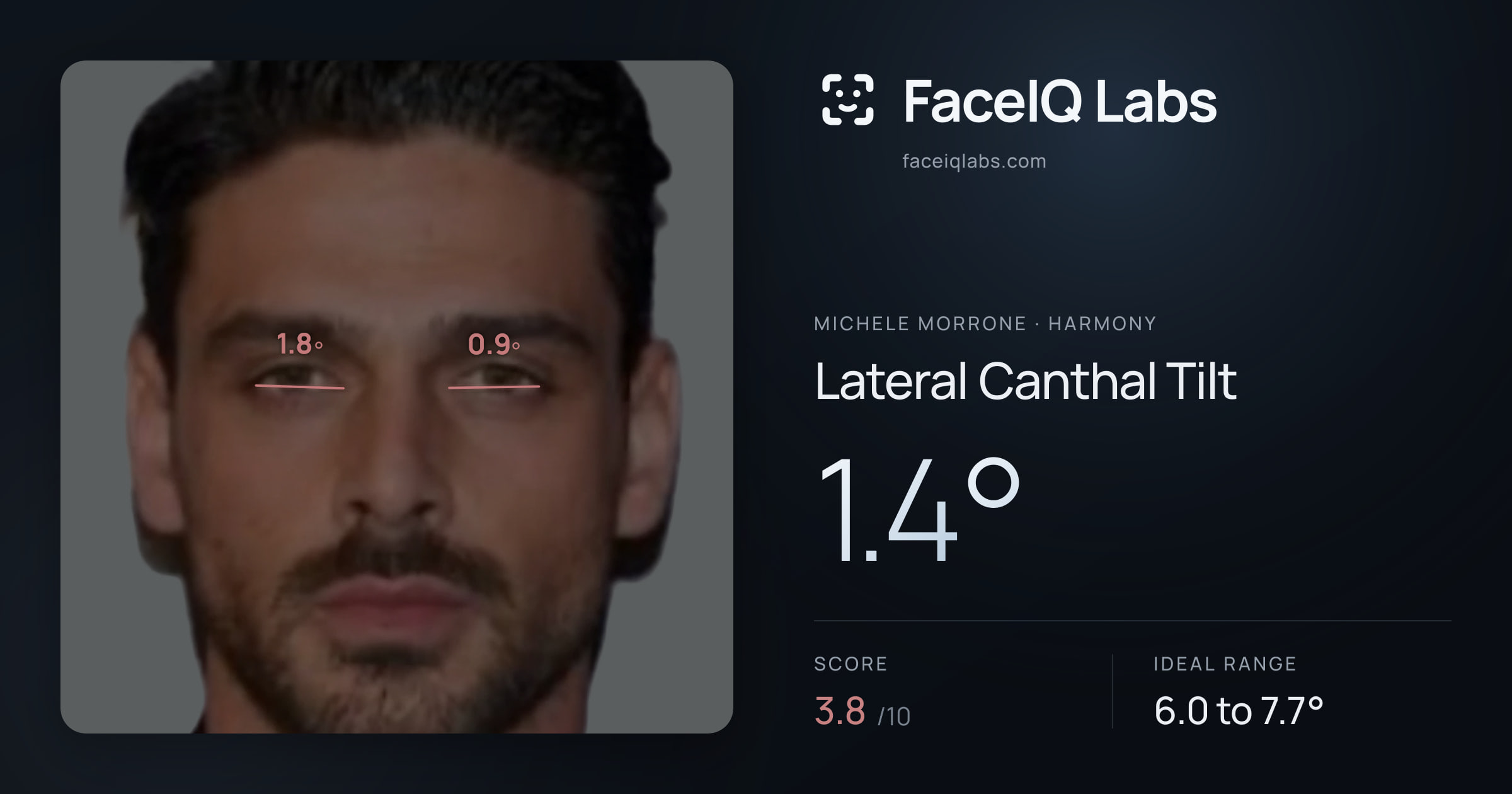 Michele Morrone Lateral Canthal Tilt: 1.4°, drawn on the photo