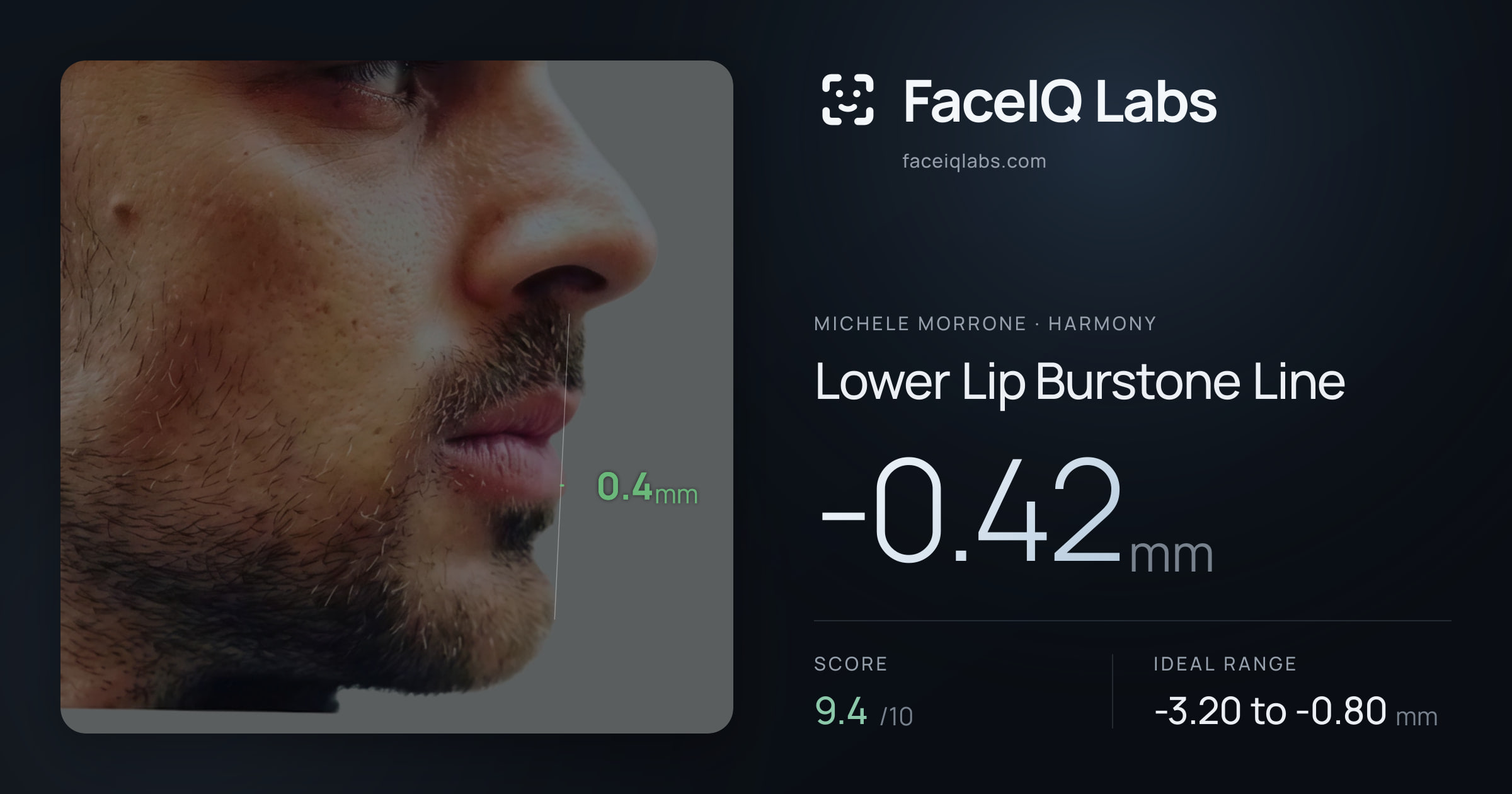 Michele Morrone Lower Lip Burstone Line: -0.42mm, drawn on the photo