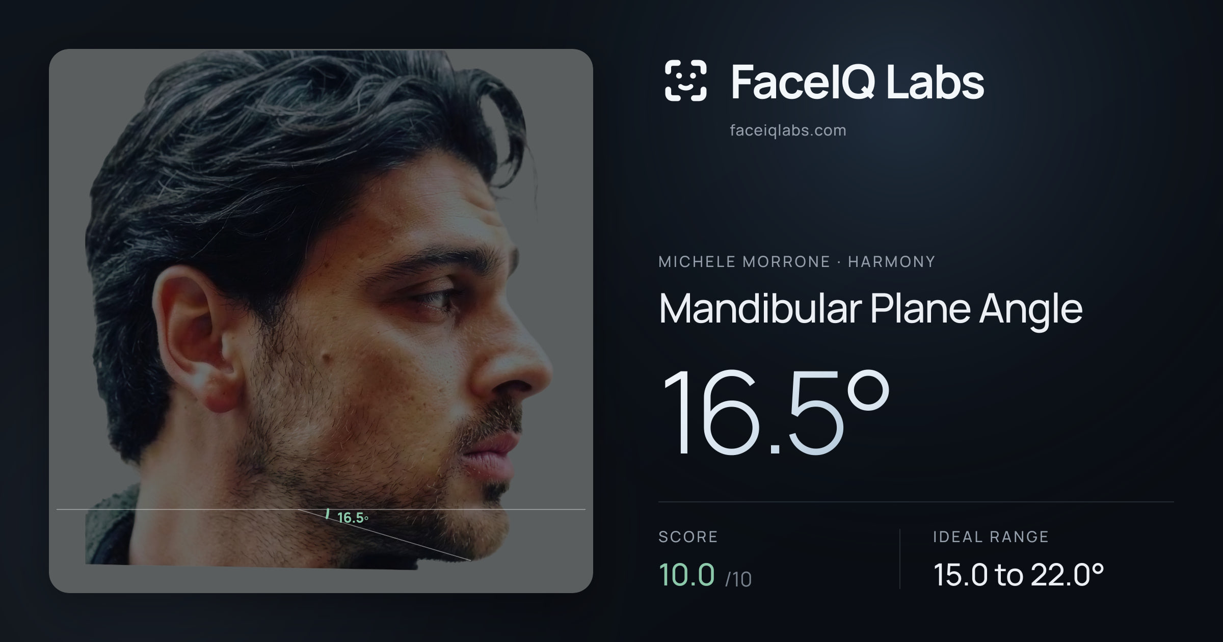 Michele Morrone Mandibular Plane Angle: 16.5°, drawn on the photo
