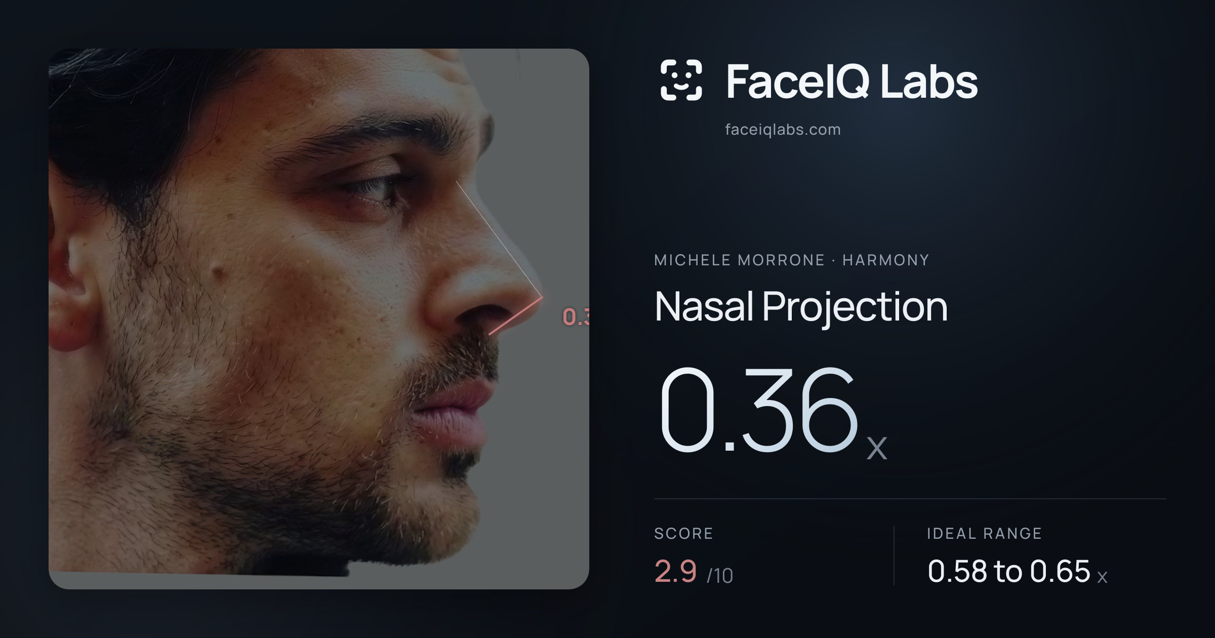 Michele Morrone Nasal Projection: 0.36x, drawn on the photo