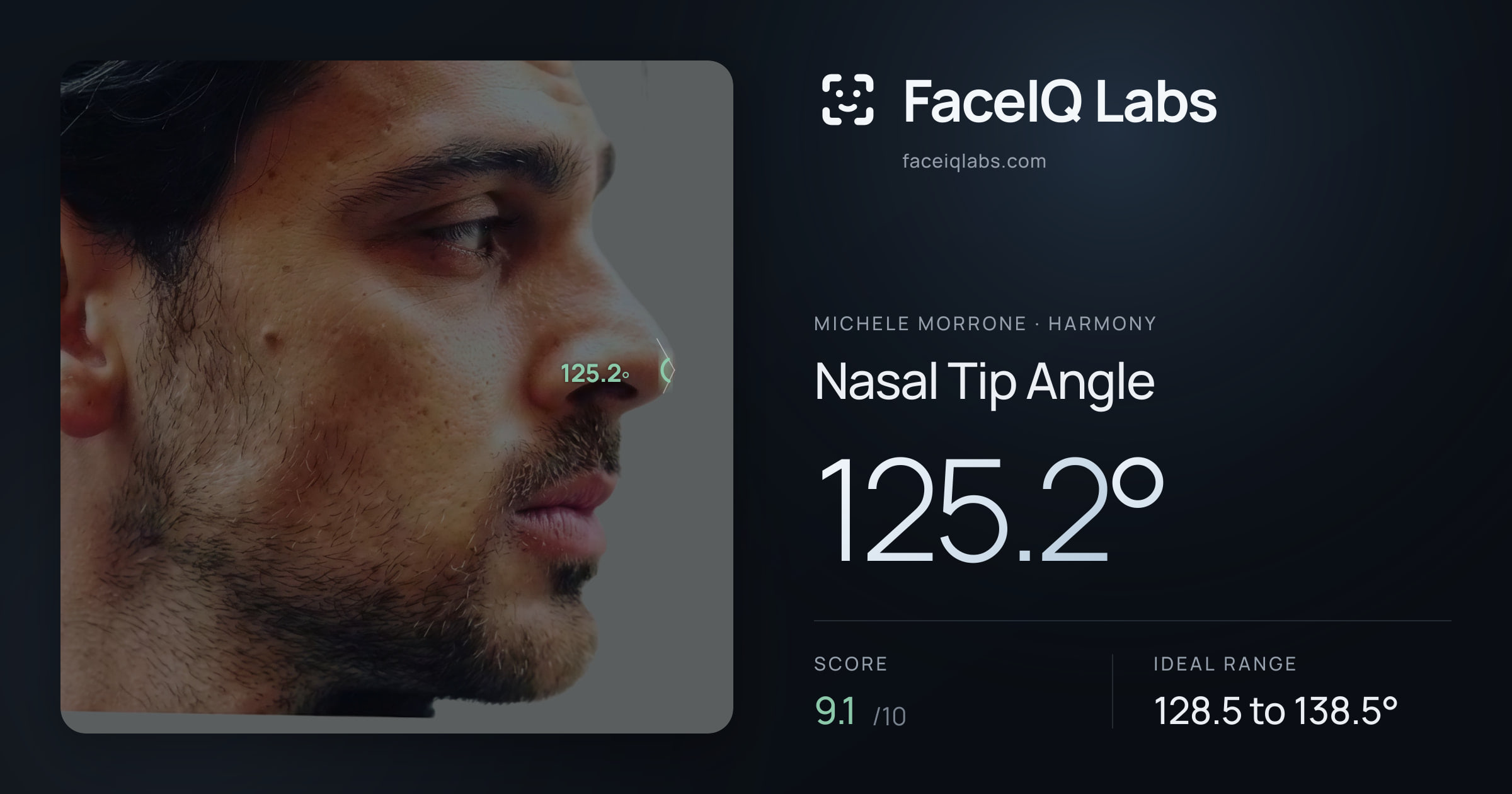 Michele Morrone Nasal Tip Angle: 125.2°, drawn on the photo