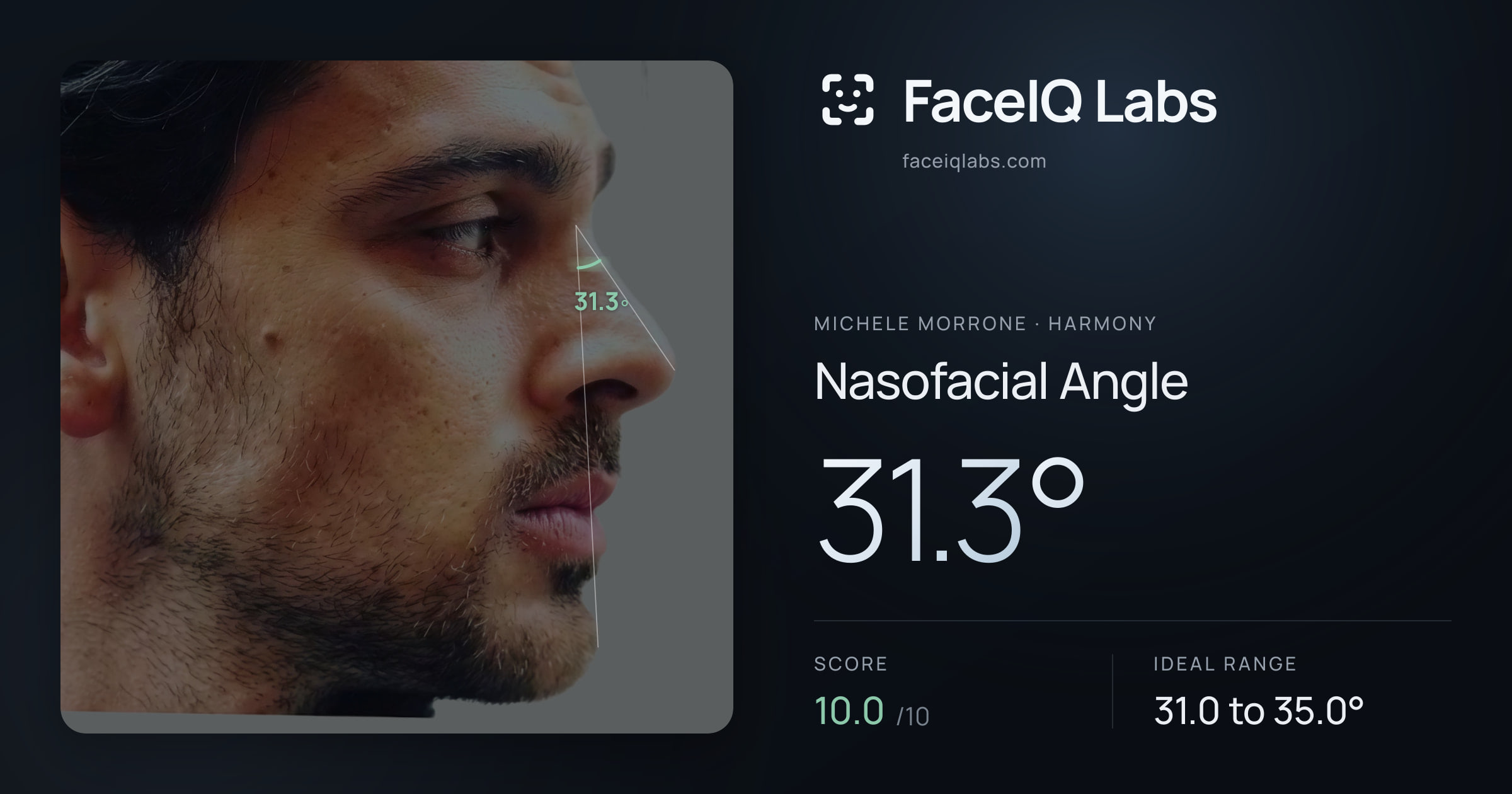 Michele Morrone Nasofacial Angle: 31.3°, drawn on the photo