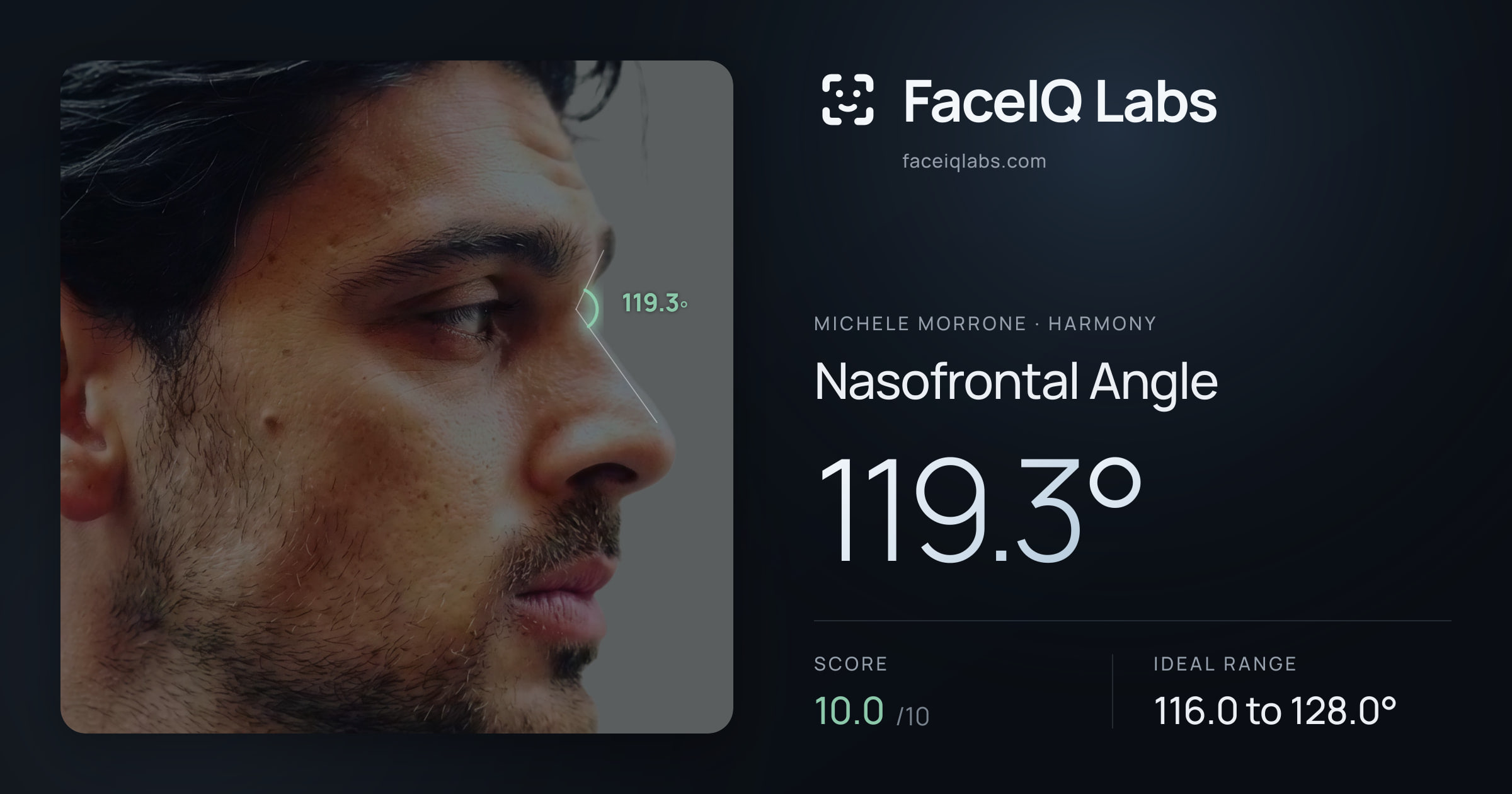 Michele Morrone Nasofrontal Angle: 119.3°, drawn on the photo