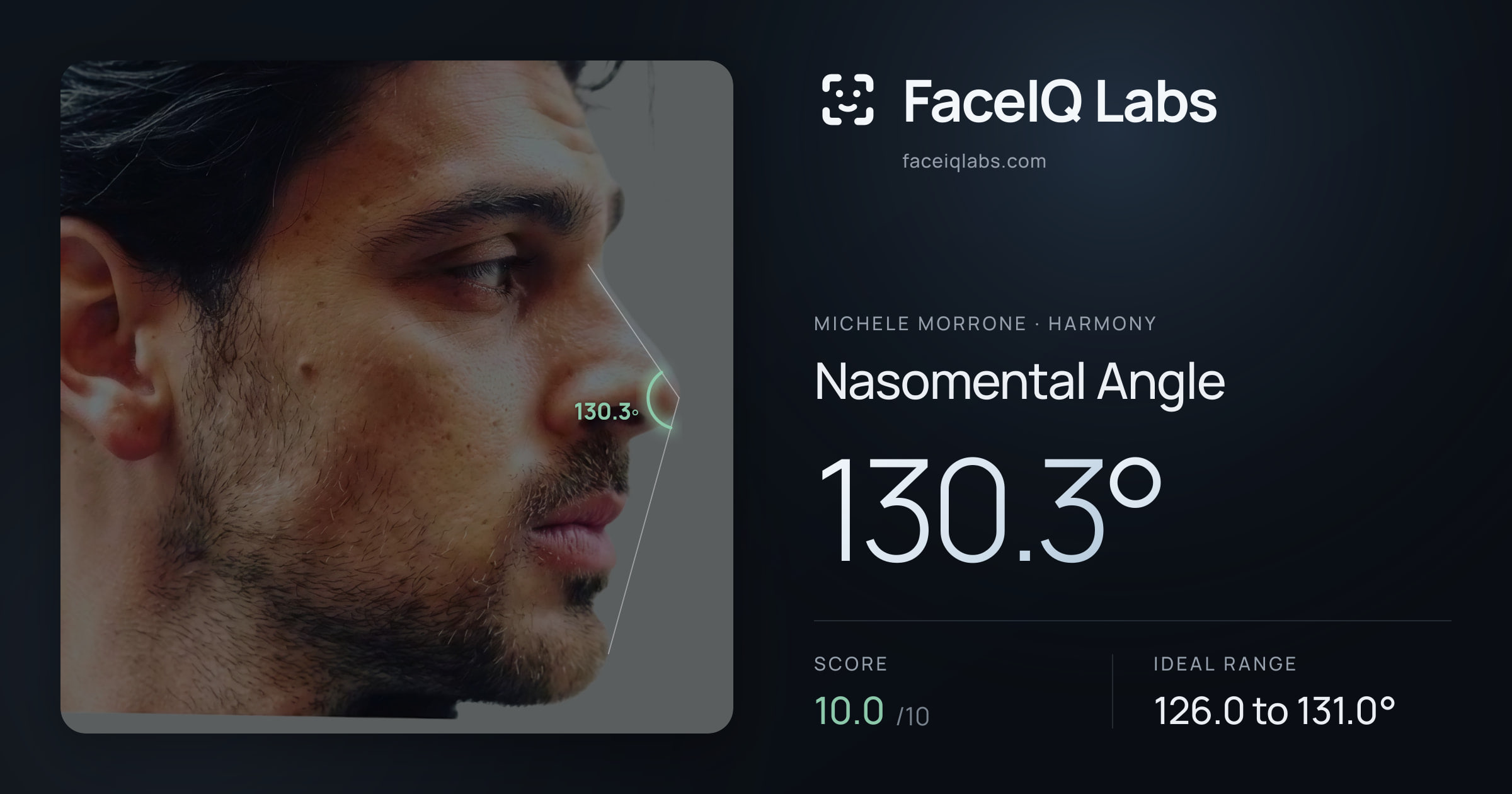 Michele Morrone Nasomental Angle: 130.3°, drawn on the photo