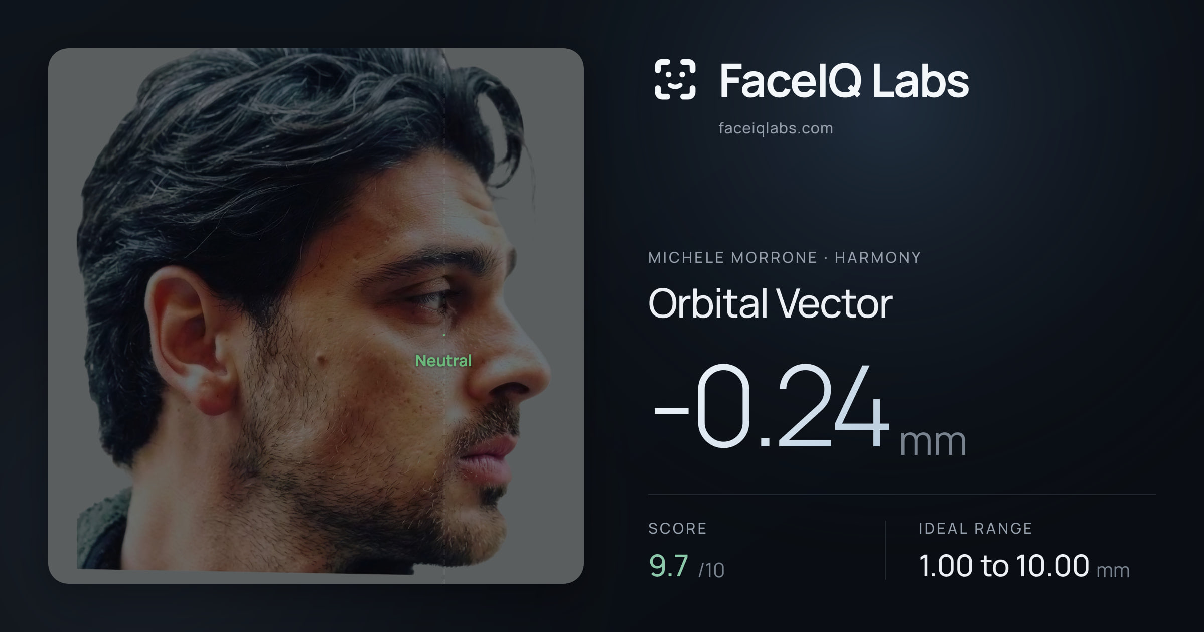 Michele Morrone Orbital Vector: -0.24mm, drawn on the photo