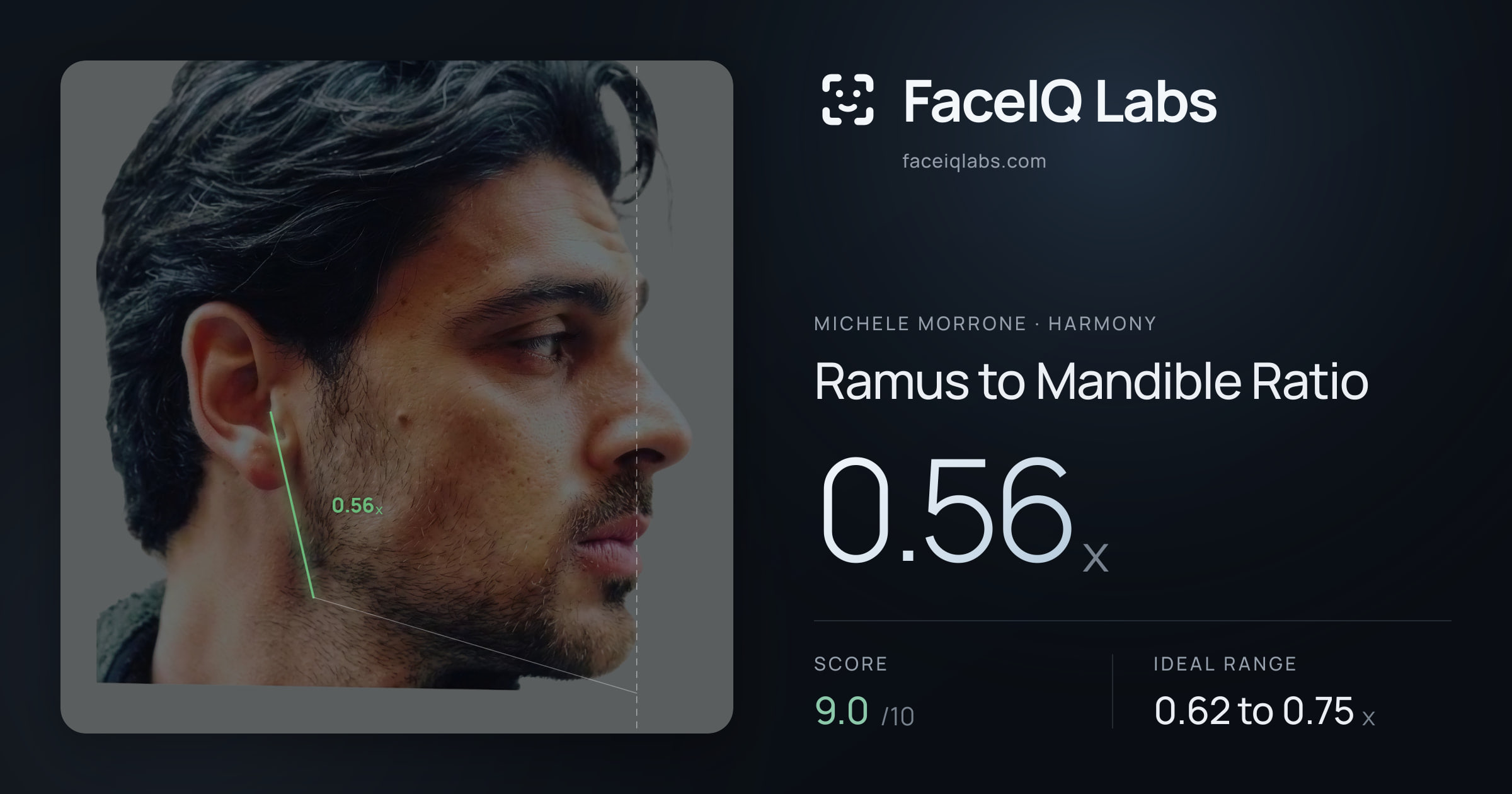 Michele Morrone Ramus to Mandible Ratio: 0.56x, drawn on the photo