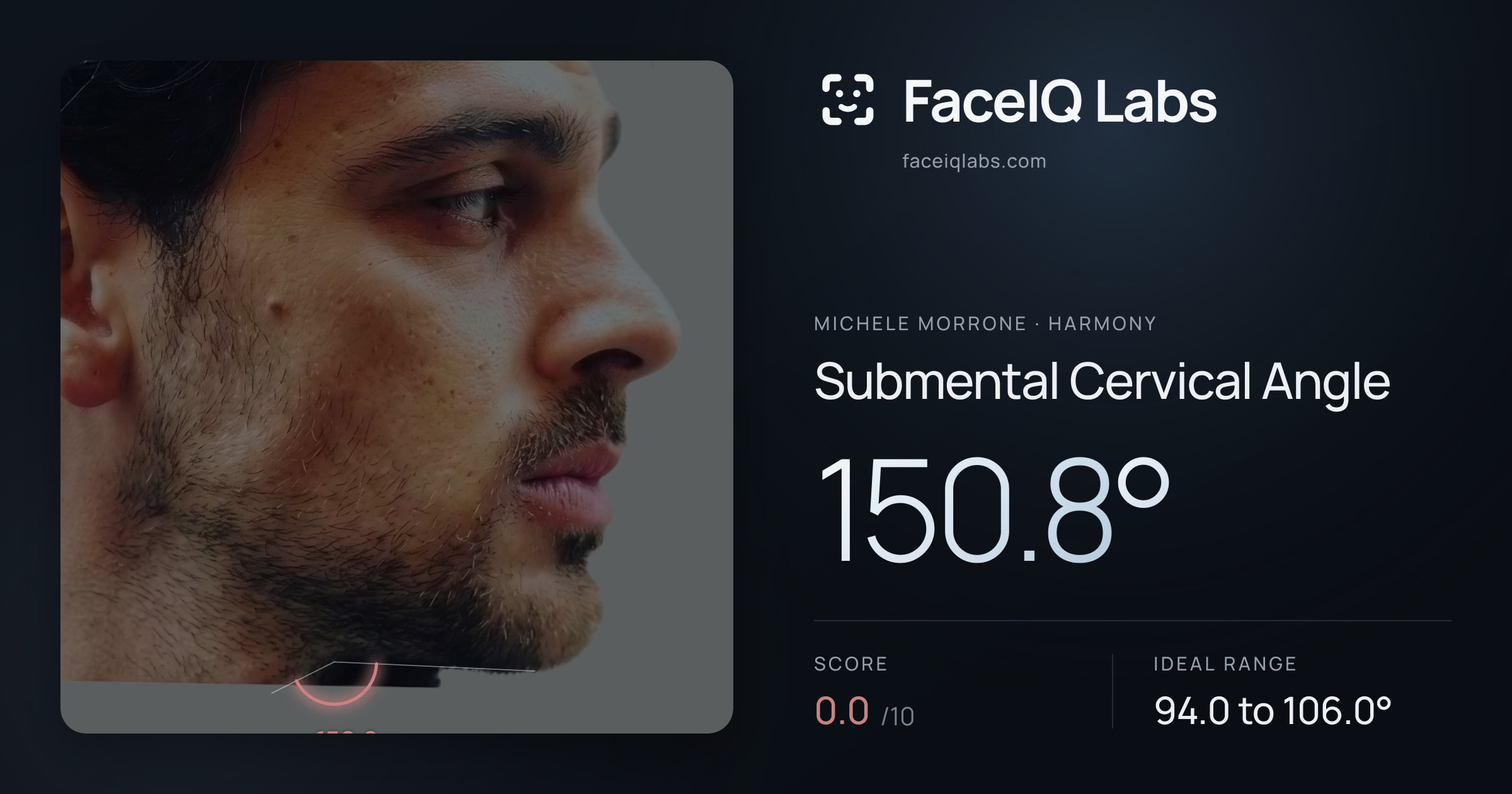 Michele Morrone Submental Cervical Angle: 150.8°, drawn on the photo