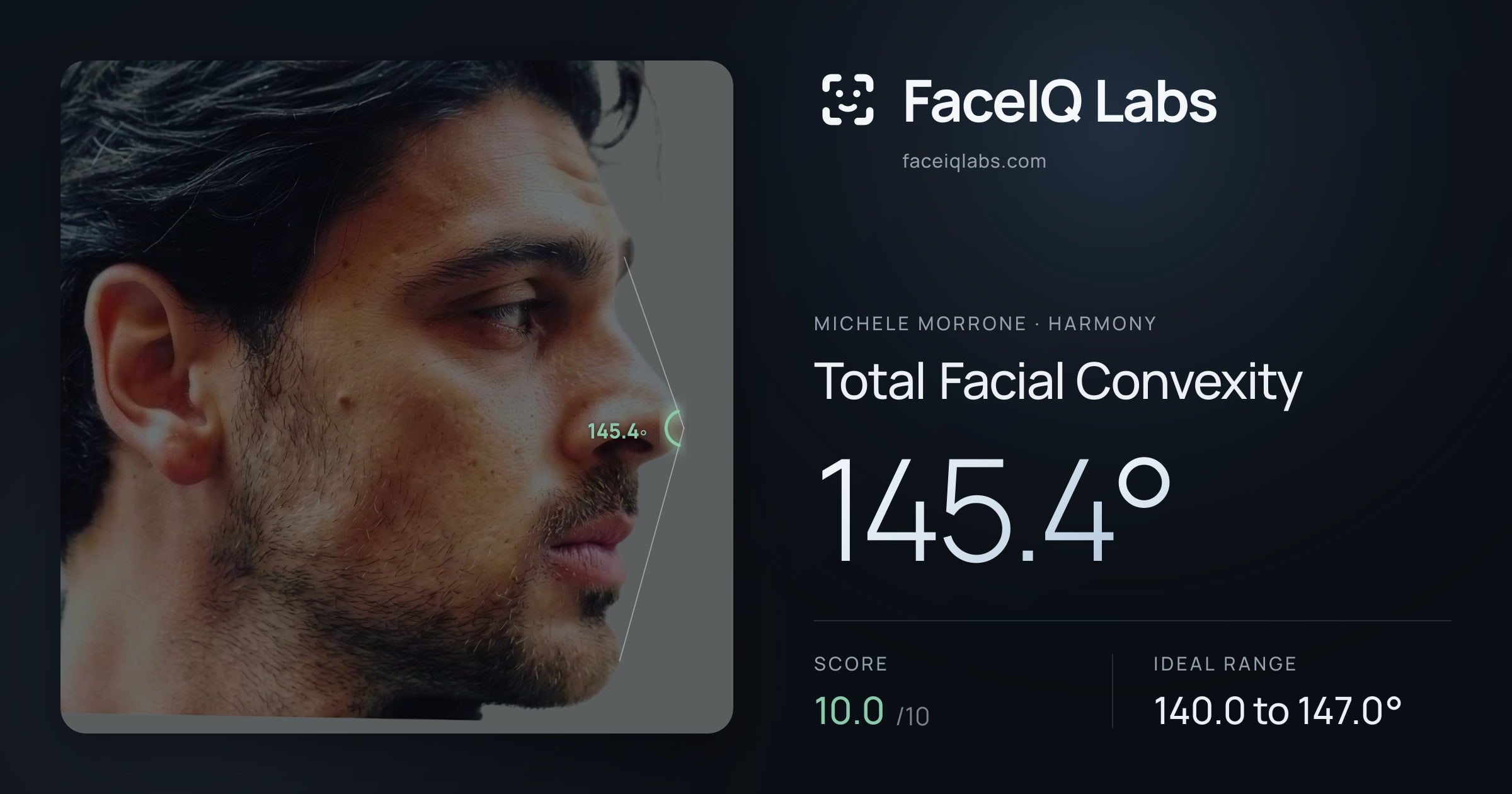 Michele Morrone Total Facial Convexity: 145.4°, drawn on the photo