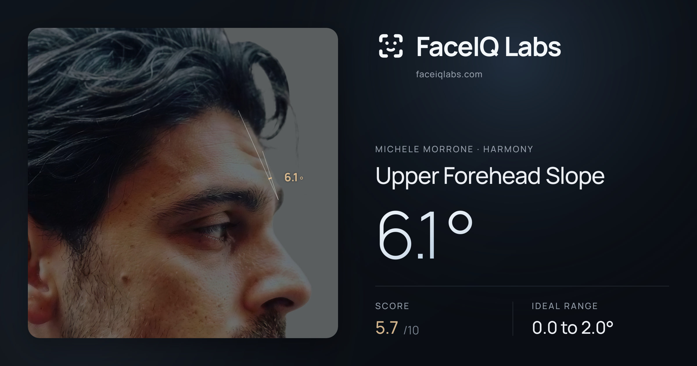 Michele Morrone Upper Forehead Slope: 6.1°, drawn on the photo
