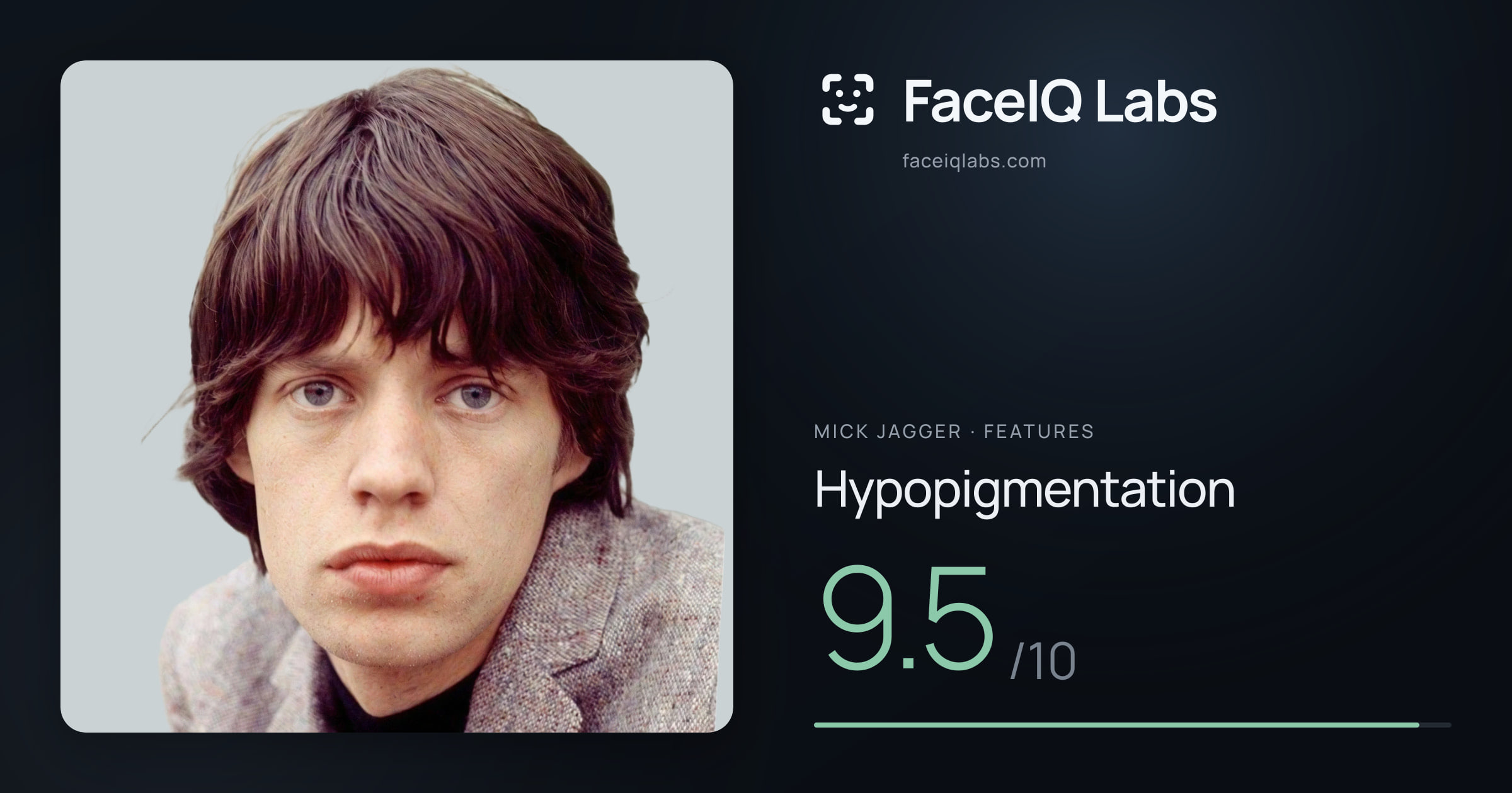 Mick Jagger Hypopigmentation: 9.5/10, drawn on the photo
