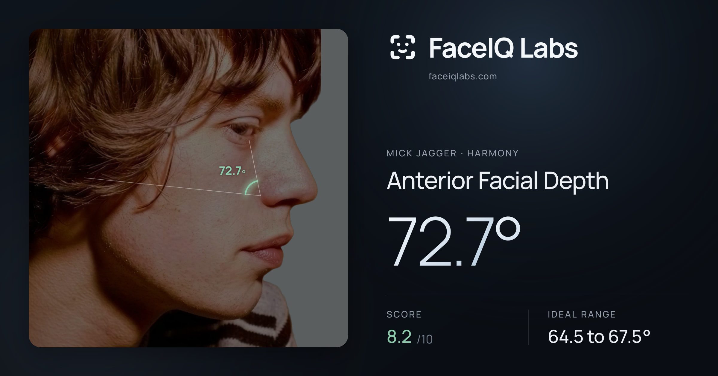 Mick Jagger Anterior Facial Depth: 72.7°, drawn on the photo