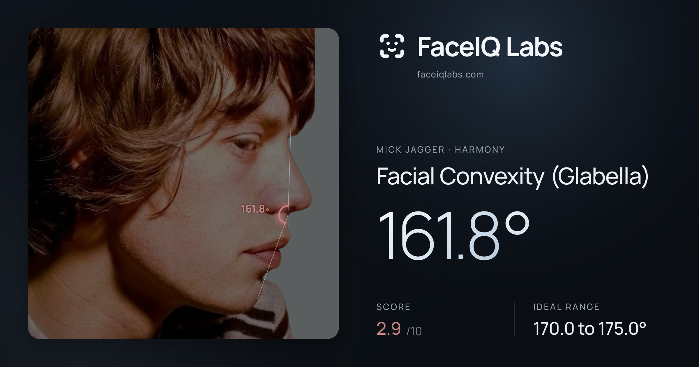 Mick Jagger Facial Convexity (Glabella): 161.8°, drawn on the photo