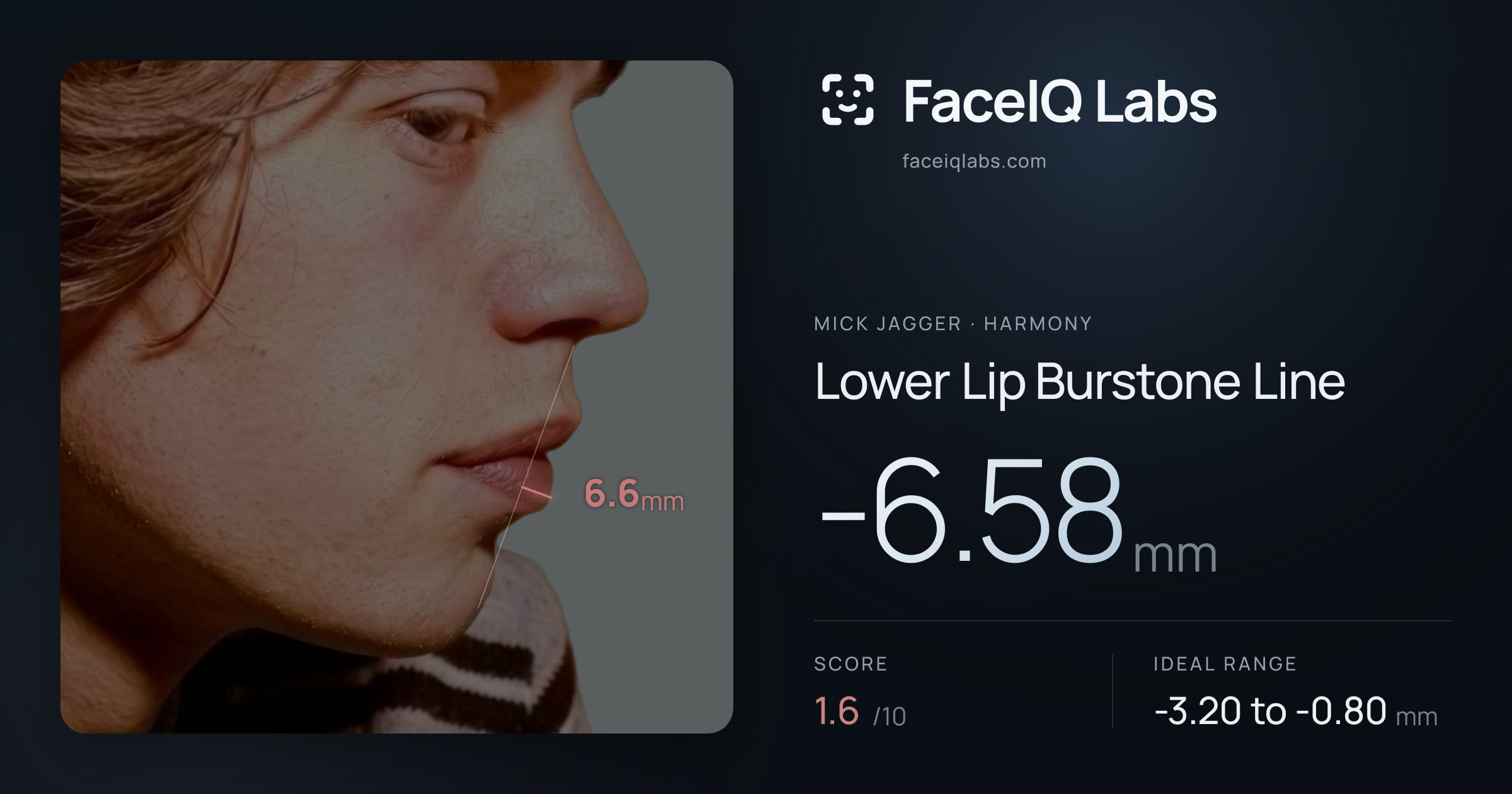Mick Jagger Lower Lip Burstone Line: -6.58mm, drawn on the photo