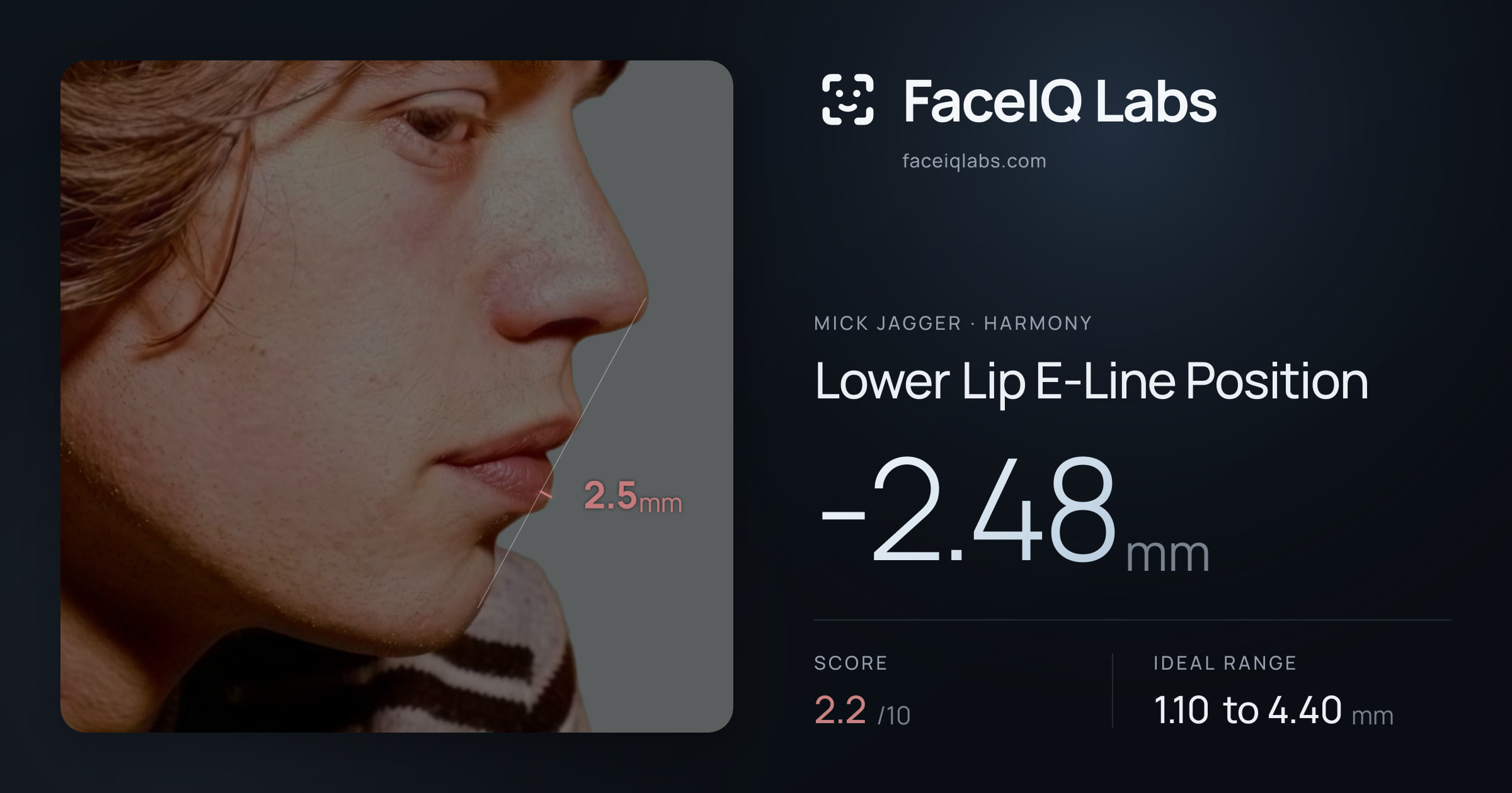Mick Jagger Lower Lip E-Line Position: -2.48mm, drawn on the photo