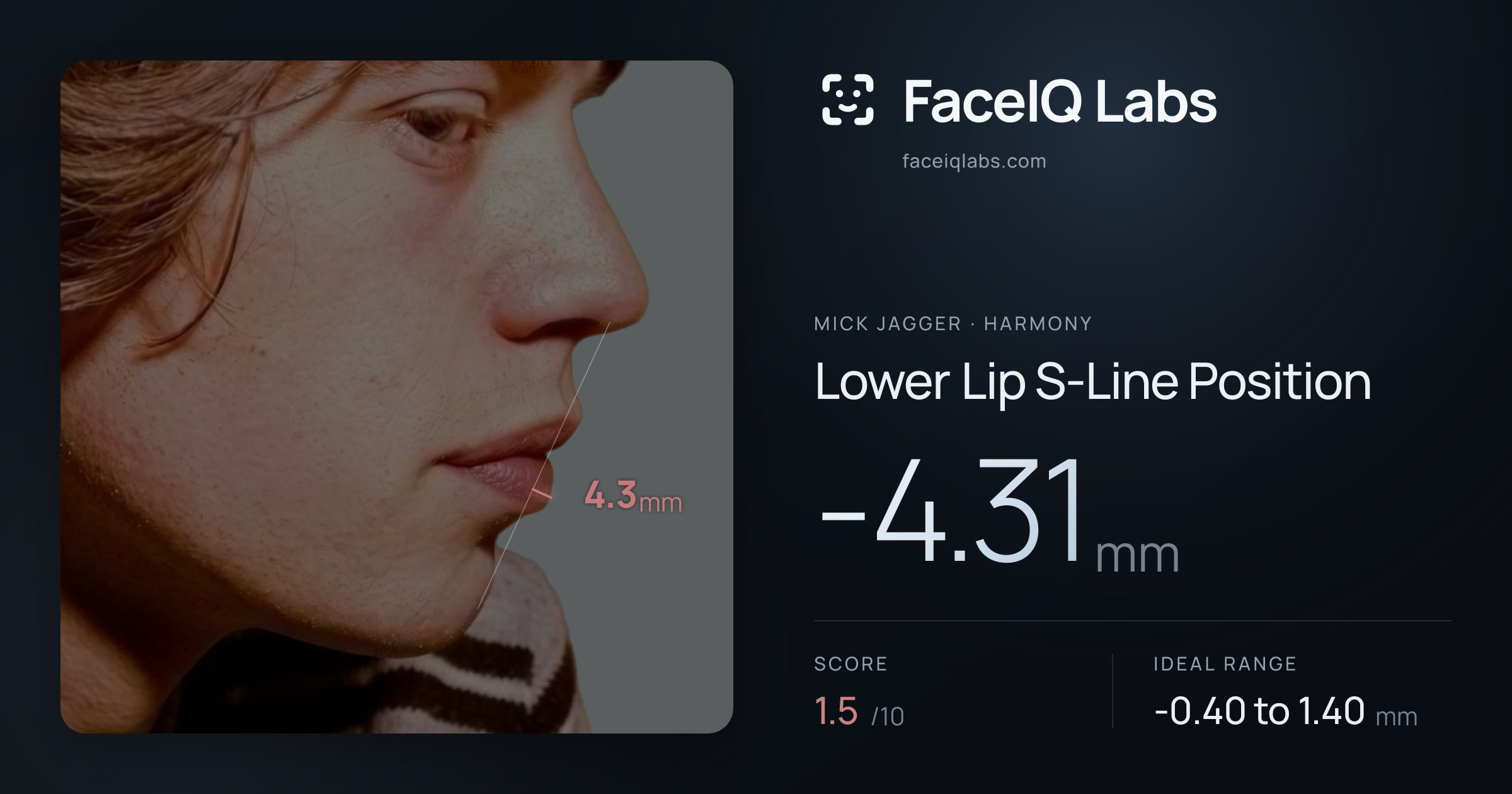 Mick Jagger Lower Lip S-Line Position: -4.31mm, drawn on the photo