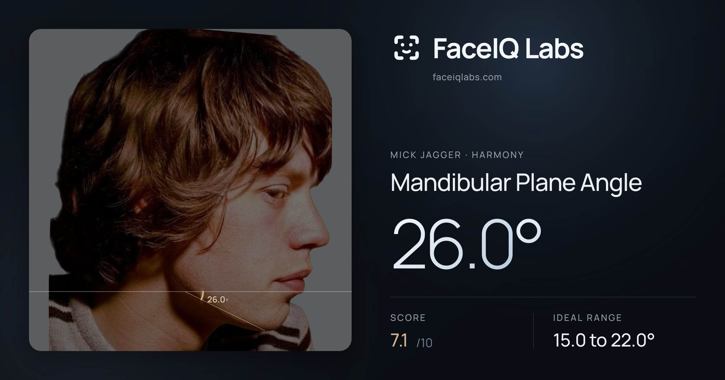 Mick Jagger Mandibular Plane Angle: 26.0°, drawn on the photo