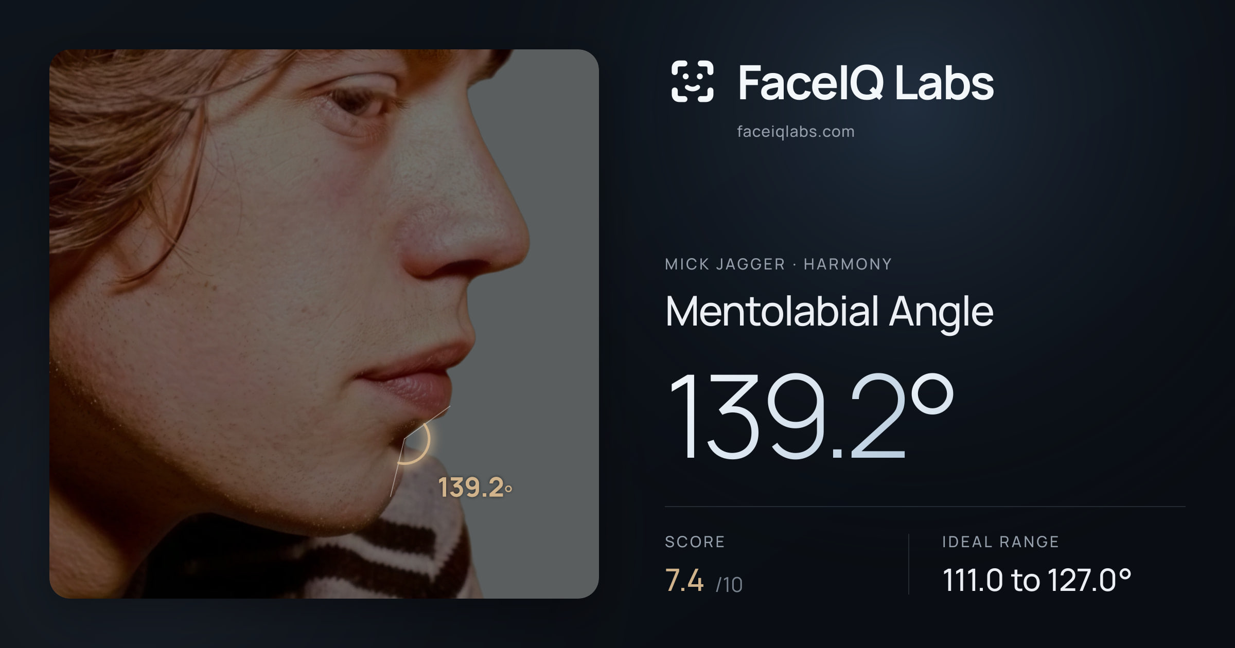 Mick Jagger Mentolabial Angle: 139.2°, drawn on the photo