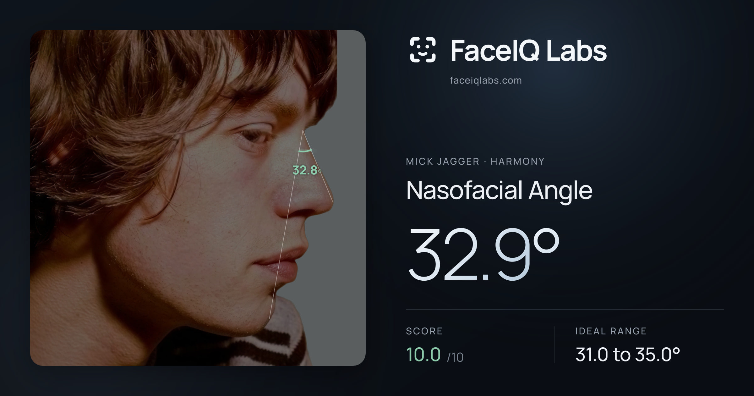 Mick Jagger Nasofacial Angle: 32.9°, drawn on the photo