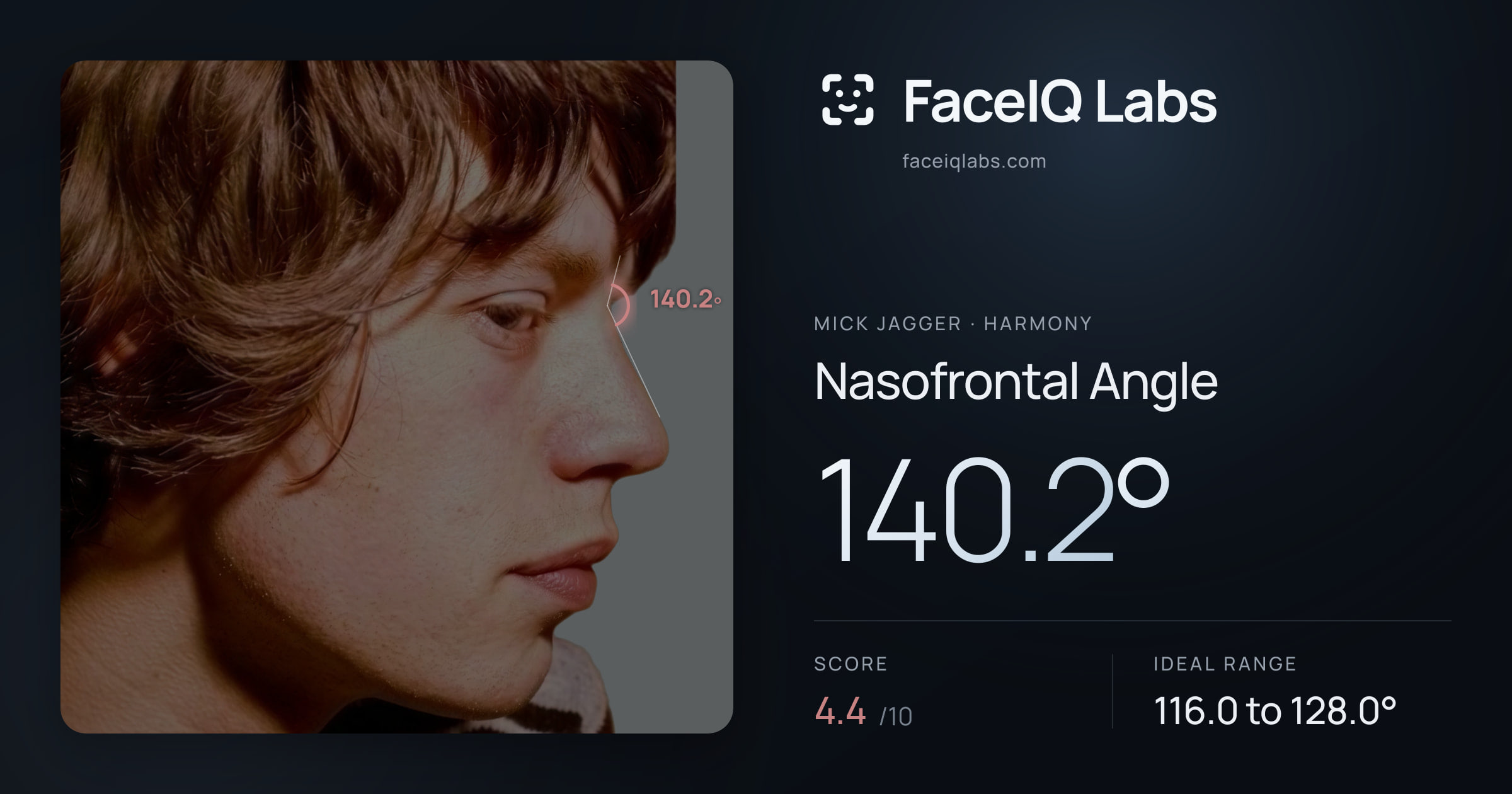 Mick Jagger Nasofrontal Angle: 140.2°, drawn on the photo