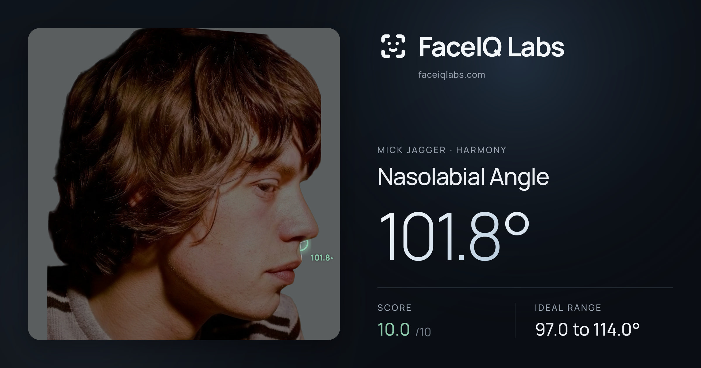 Mick Jagger Nasolabial Angle: 101.8°, drawn on the photo