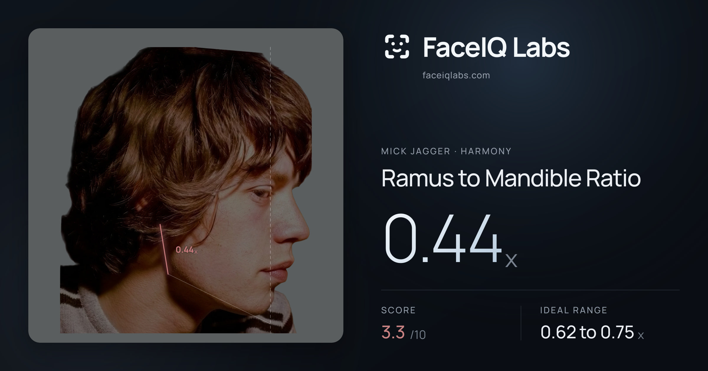 Mick Jagger Ramus to Mandible Ratio: 0.44x, drawn on the photo