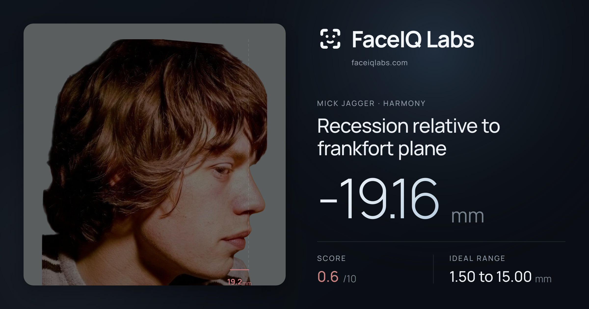 Mick Jagger Recession relative to frankfort plane: -19.16mm, drawn on the photo