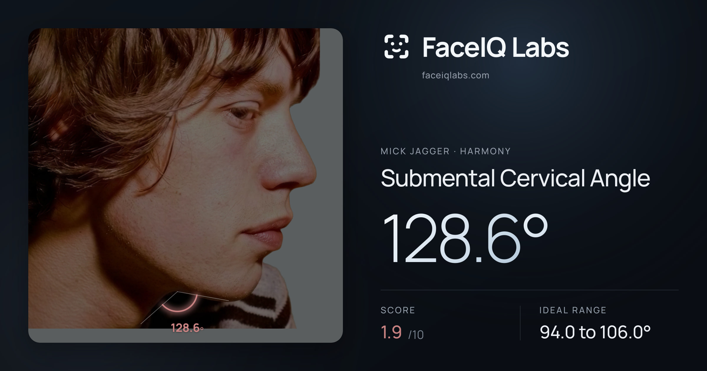 Mick Jagger Submental Cervical Angle: 128.6°, drawn on the photo