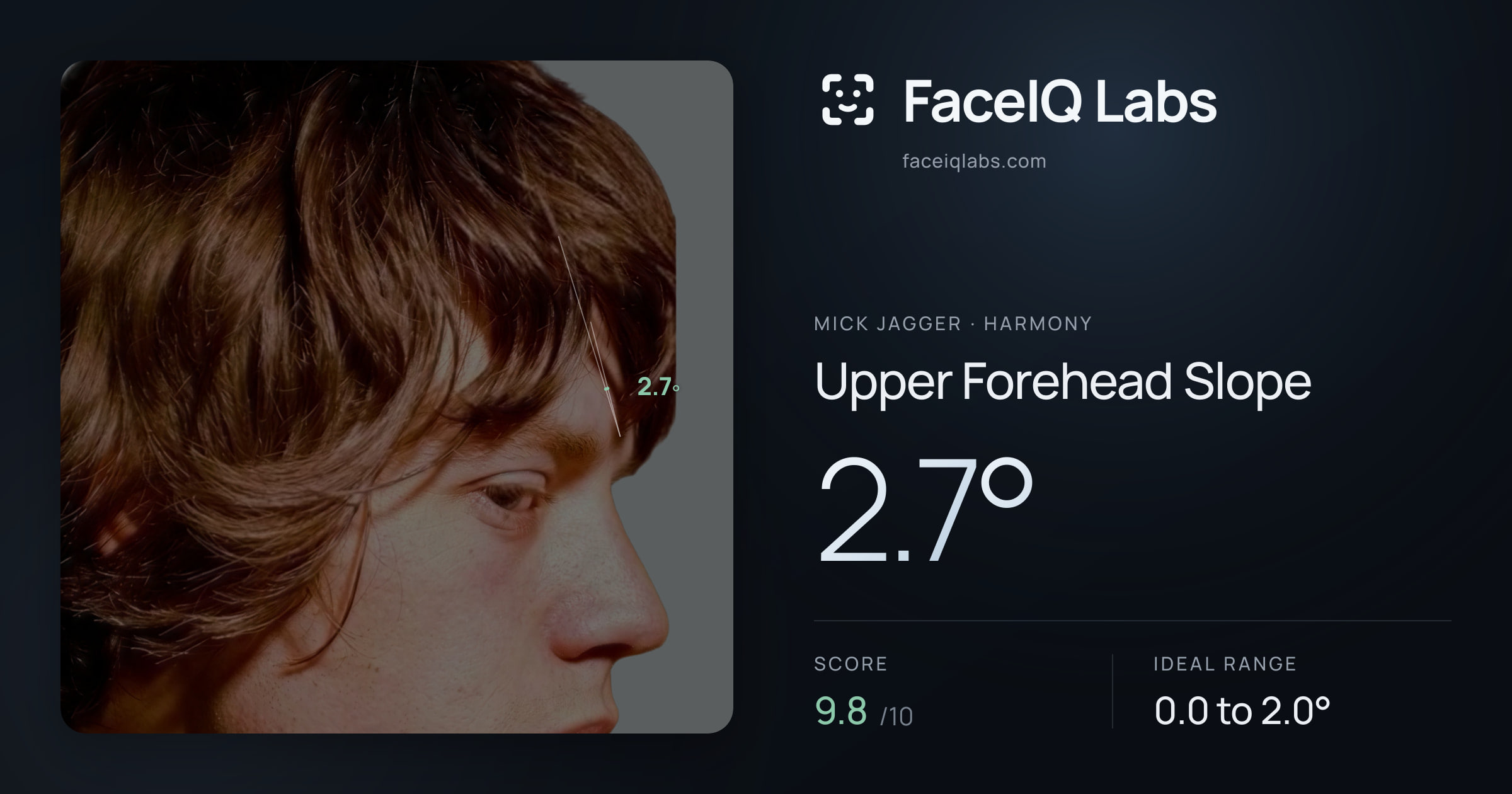Mick Jagger Upper Forehead Slope: 2.7°, drawn on the photo