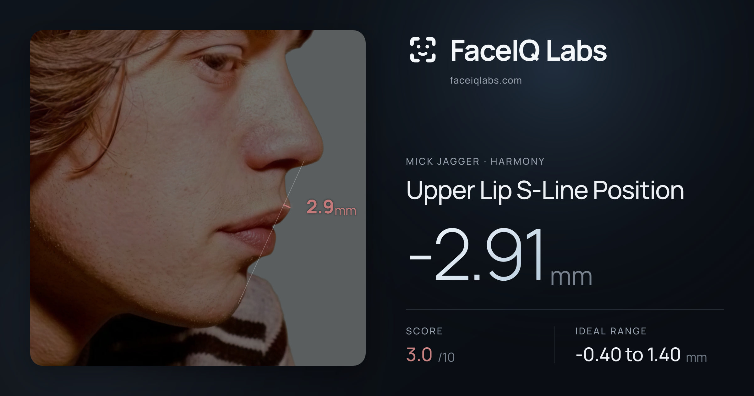 Mick Jagger Upper Lip S-Line Position: -2.91mm, drawn on the photo