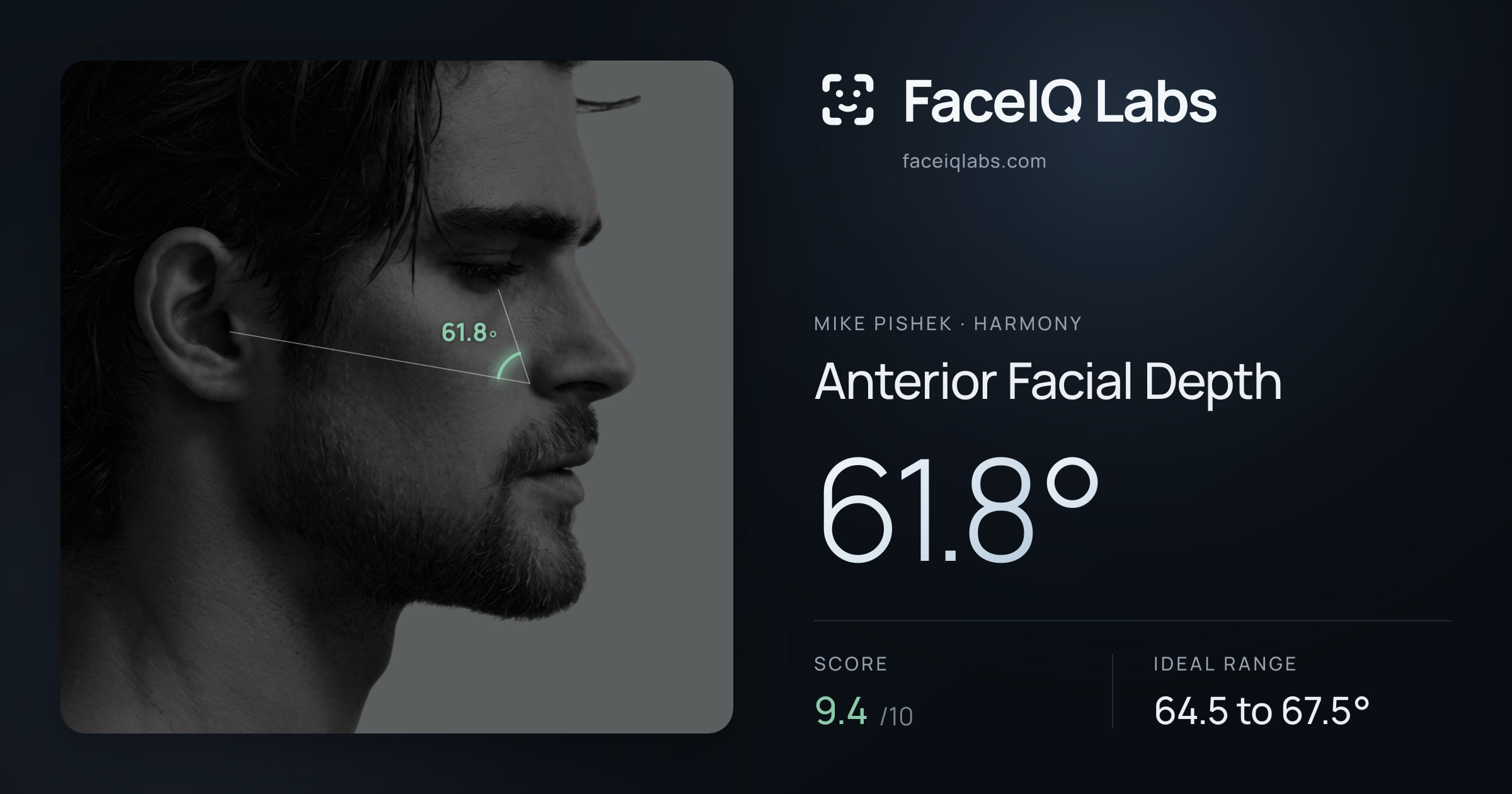 Mike Pishek Anterior Facial Depth: 61.8°, drawn on the photo