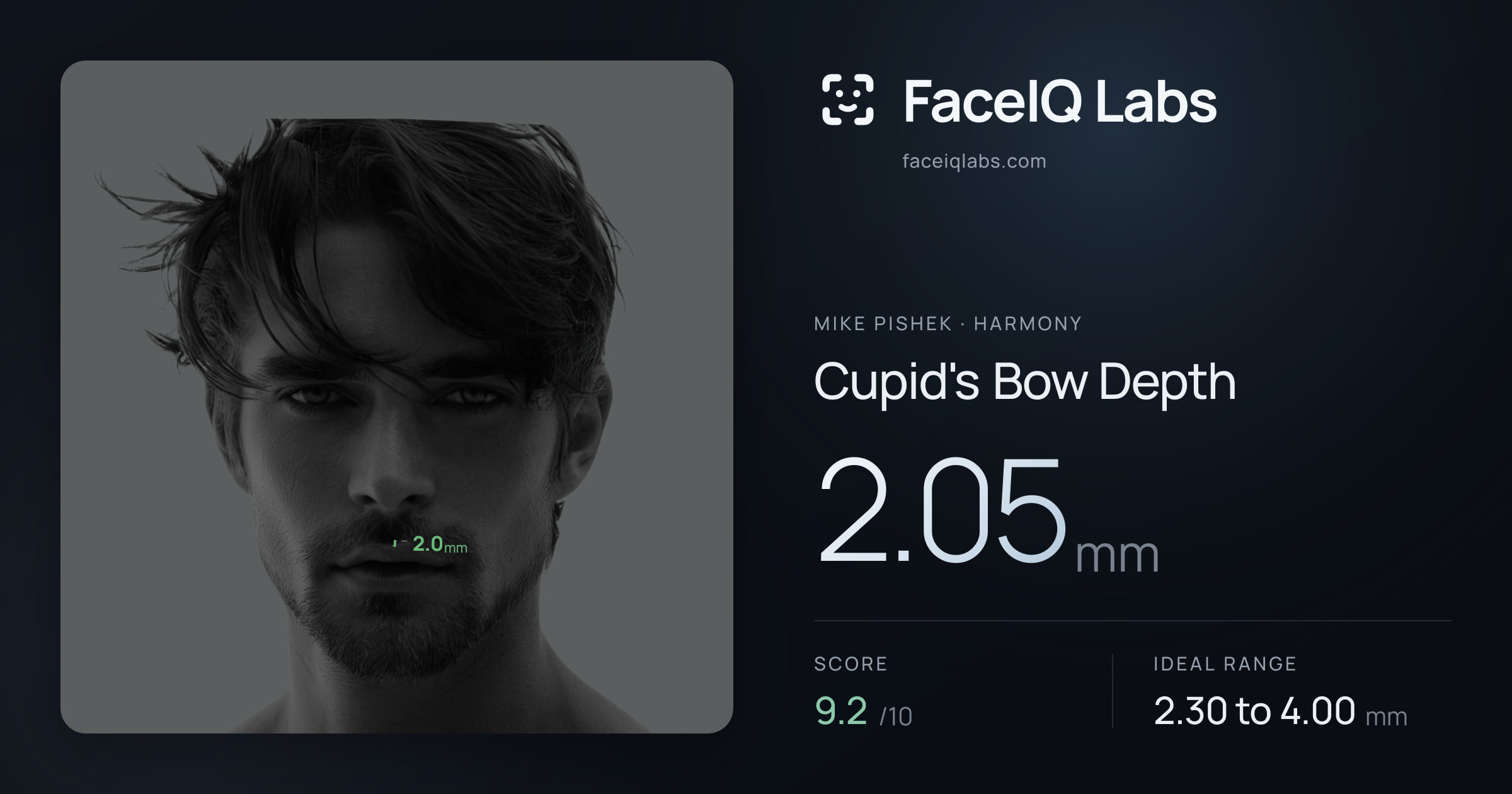 Mike Pishek Cupid's Bow Depth: 2.05mm, drawn on the photo