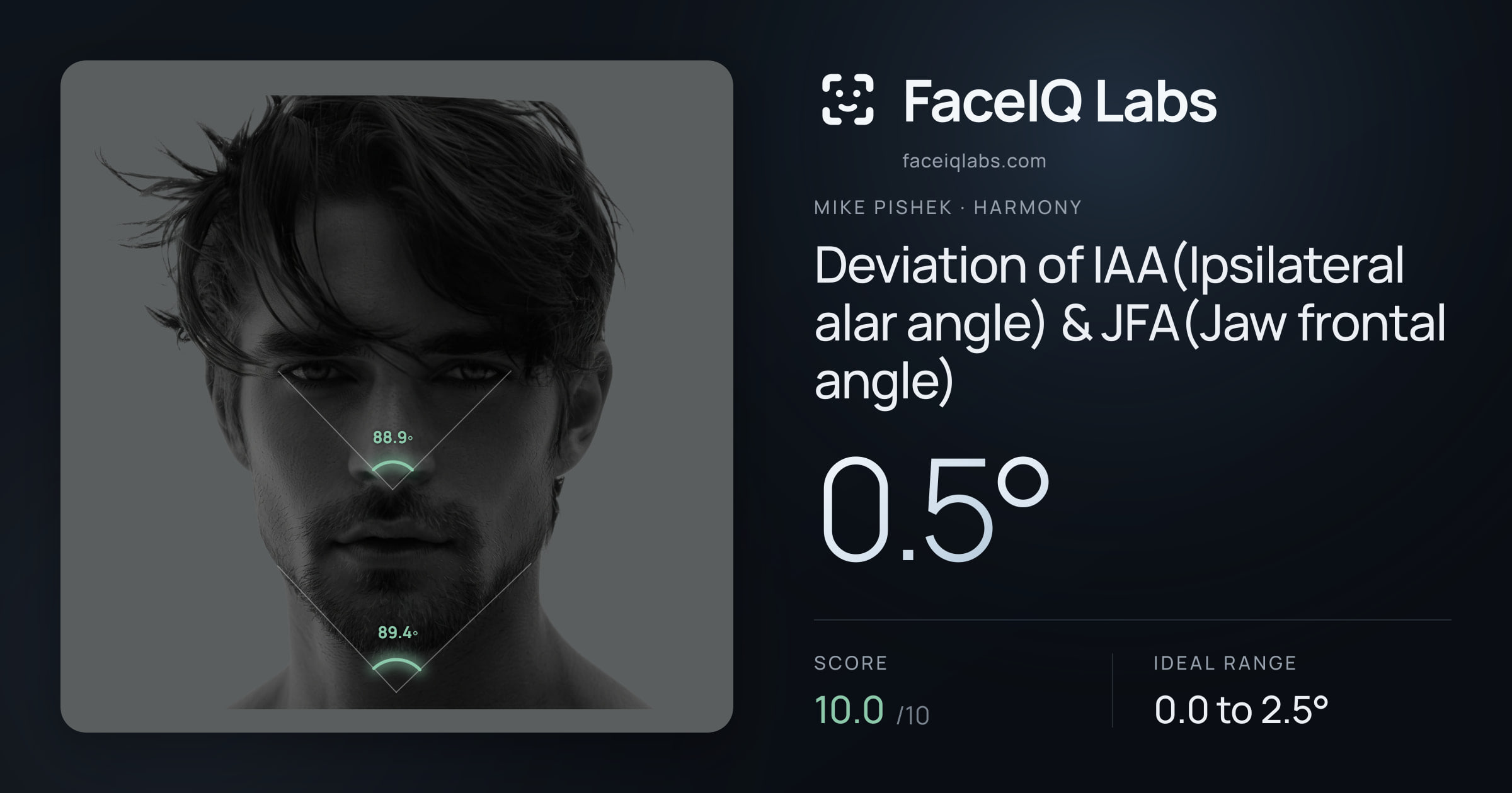 Mike Pishek Deviation of IAA(Ipsilateral alar angle) & JFA(Jaw frontal angle): 0.5°, drawn on the photo