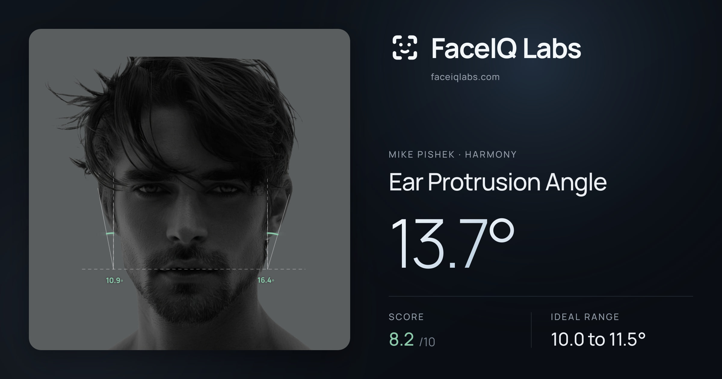 Mike Pishek Ear Protrusion Angle: 13.7°, drawn on the photo