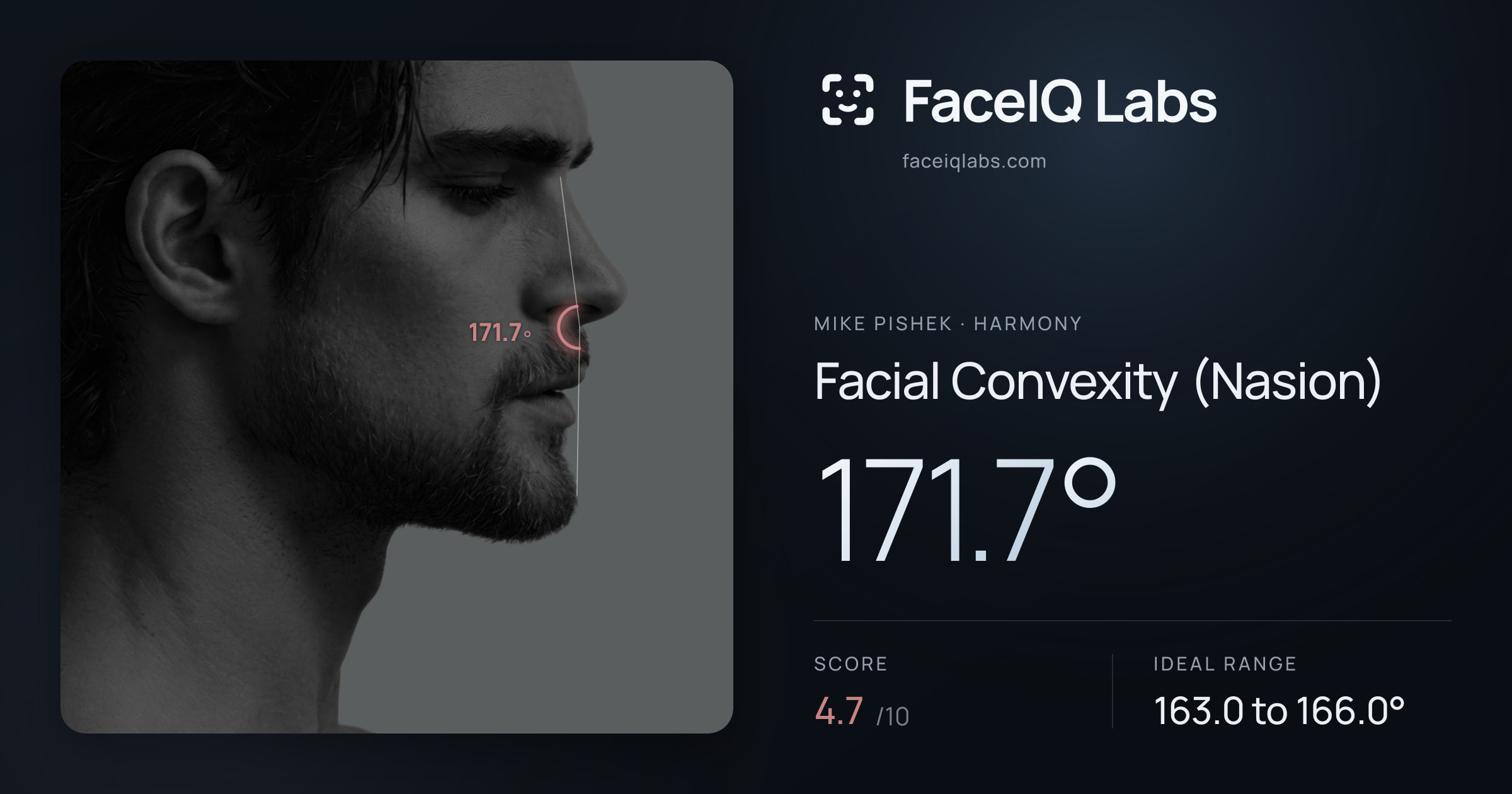 Mike Pishek Facial Convexity (Nasion): 171.7°, drawn on the photo