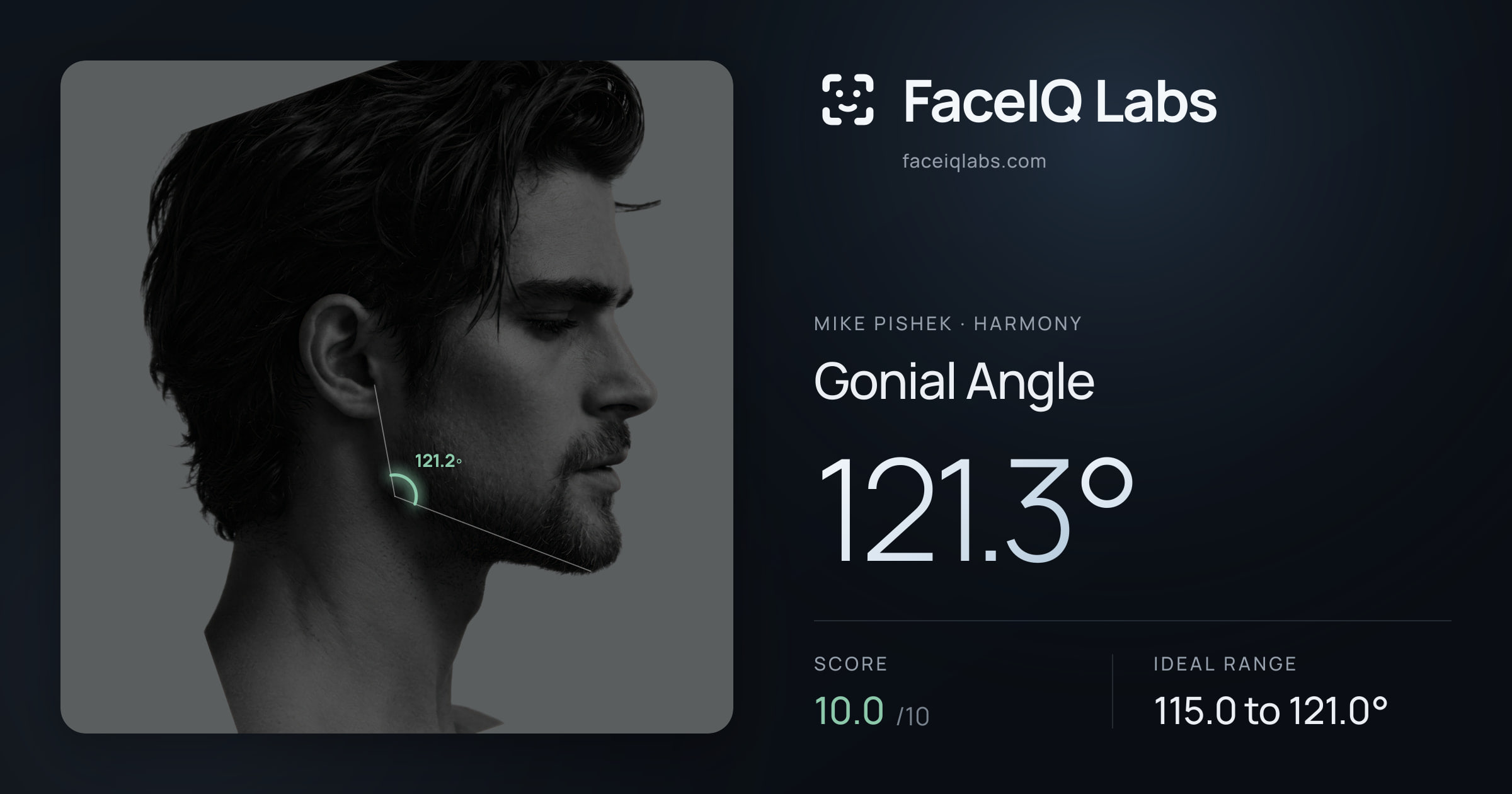 Mike Pishek Gonial Angle: 121.3°, drawn on the photo