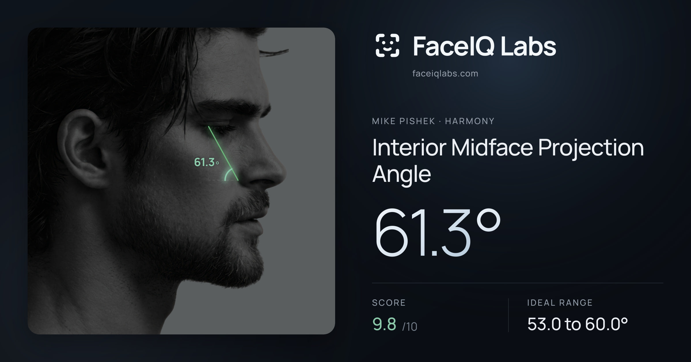 Mike Pishek Interior Midface Projection Angle: 61.3°, drawn on the photo